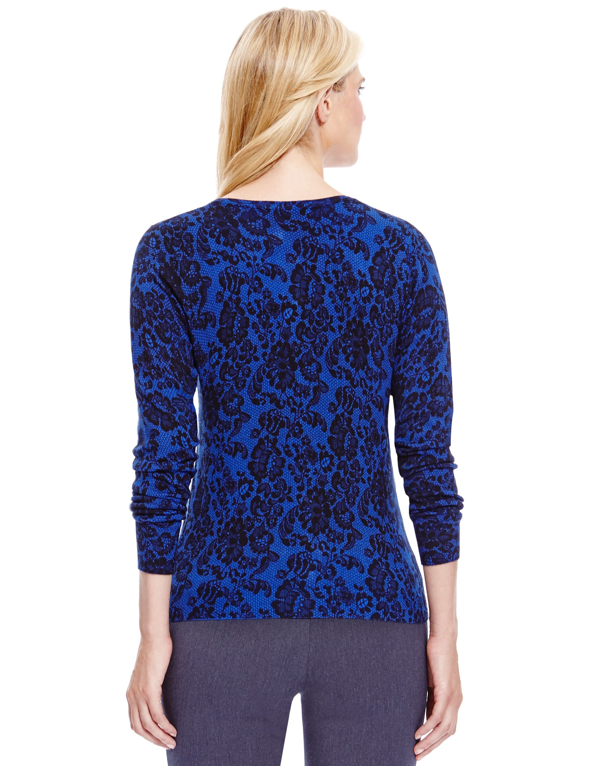 Lace Print Bobble Button Cardigan Image 2 of 4