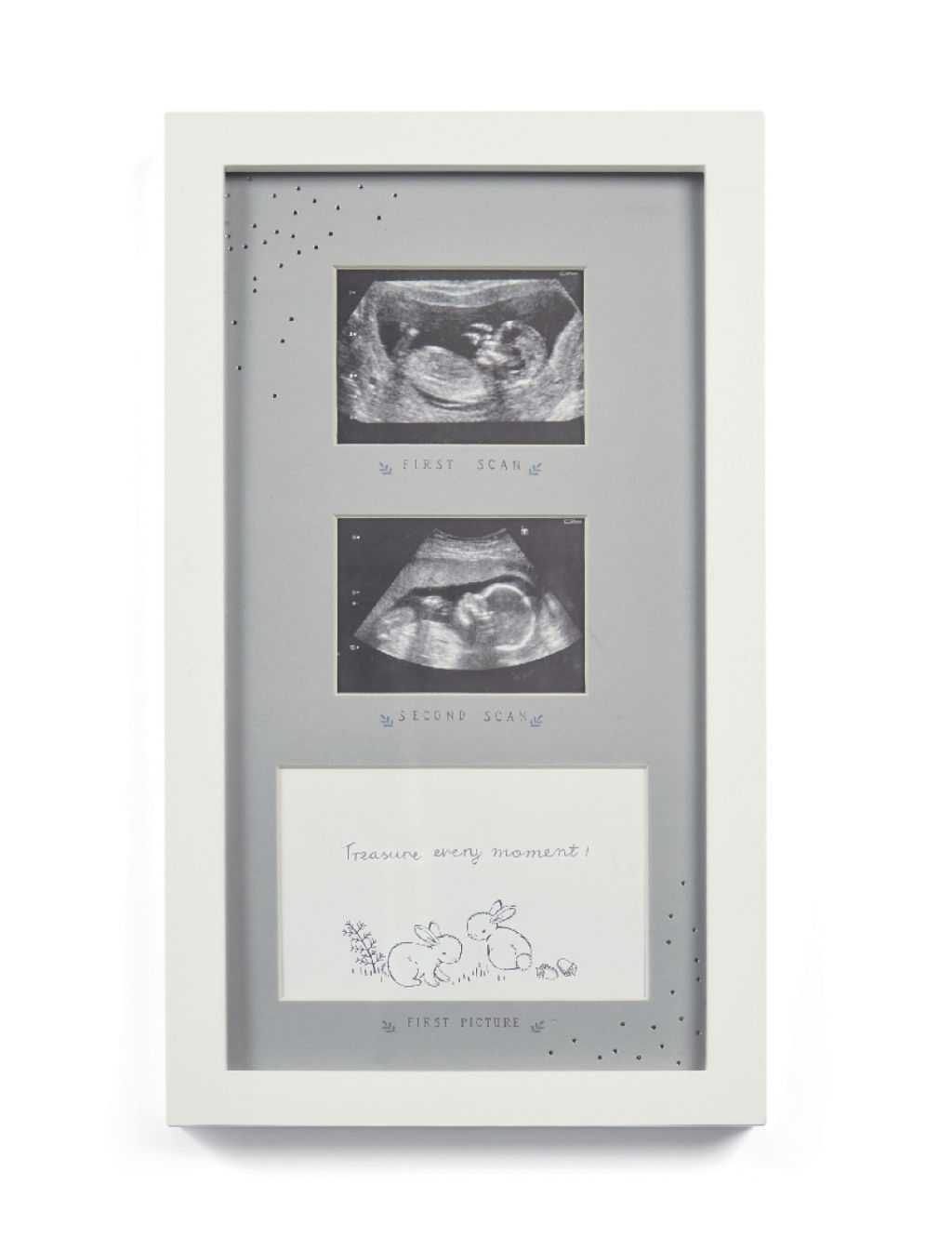 Forever Treasured Baby Photo Frame