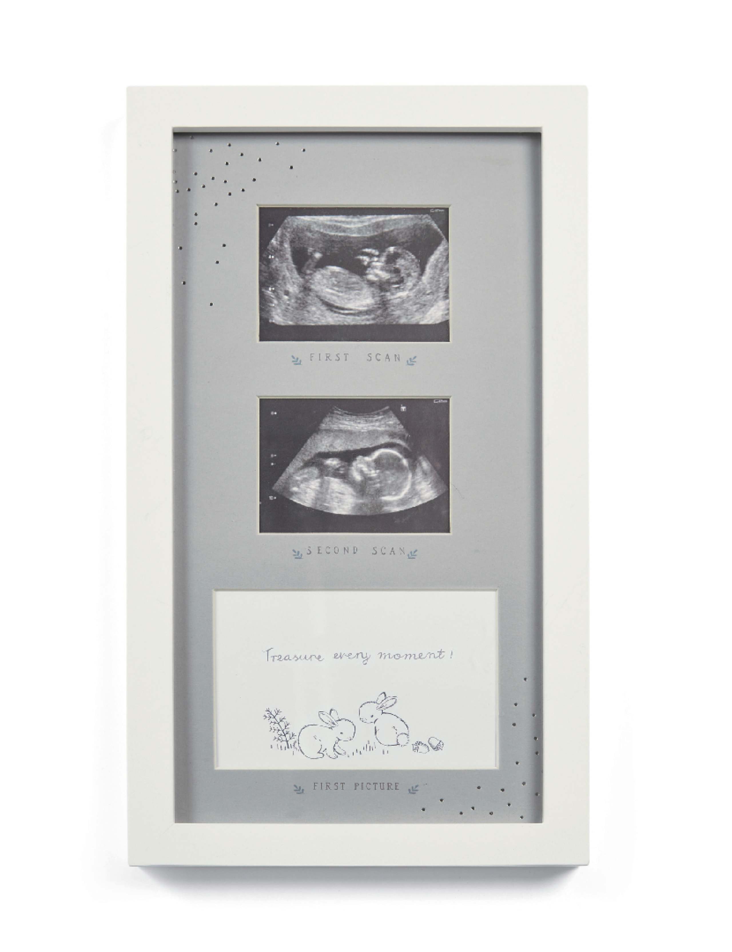 Forever Treasured Baby Photo Frame