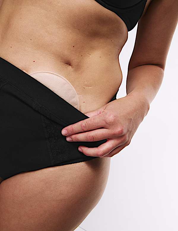3pk Cotton Rich Lace High Waisted Stoma Thongs
