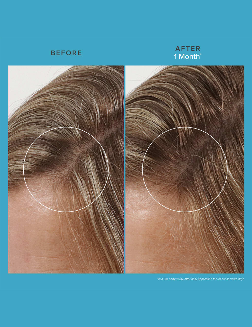 Scalp Care Revitalizing Treatment 73ml 4 of 5