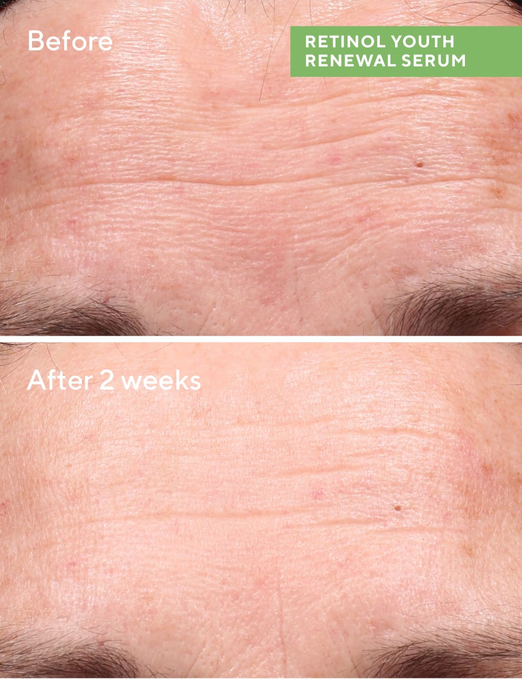Retinol Youth Renewal Serum 30ml 4 of 8