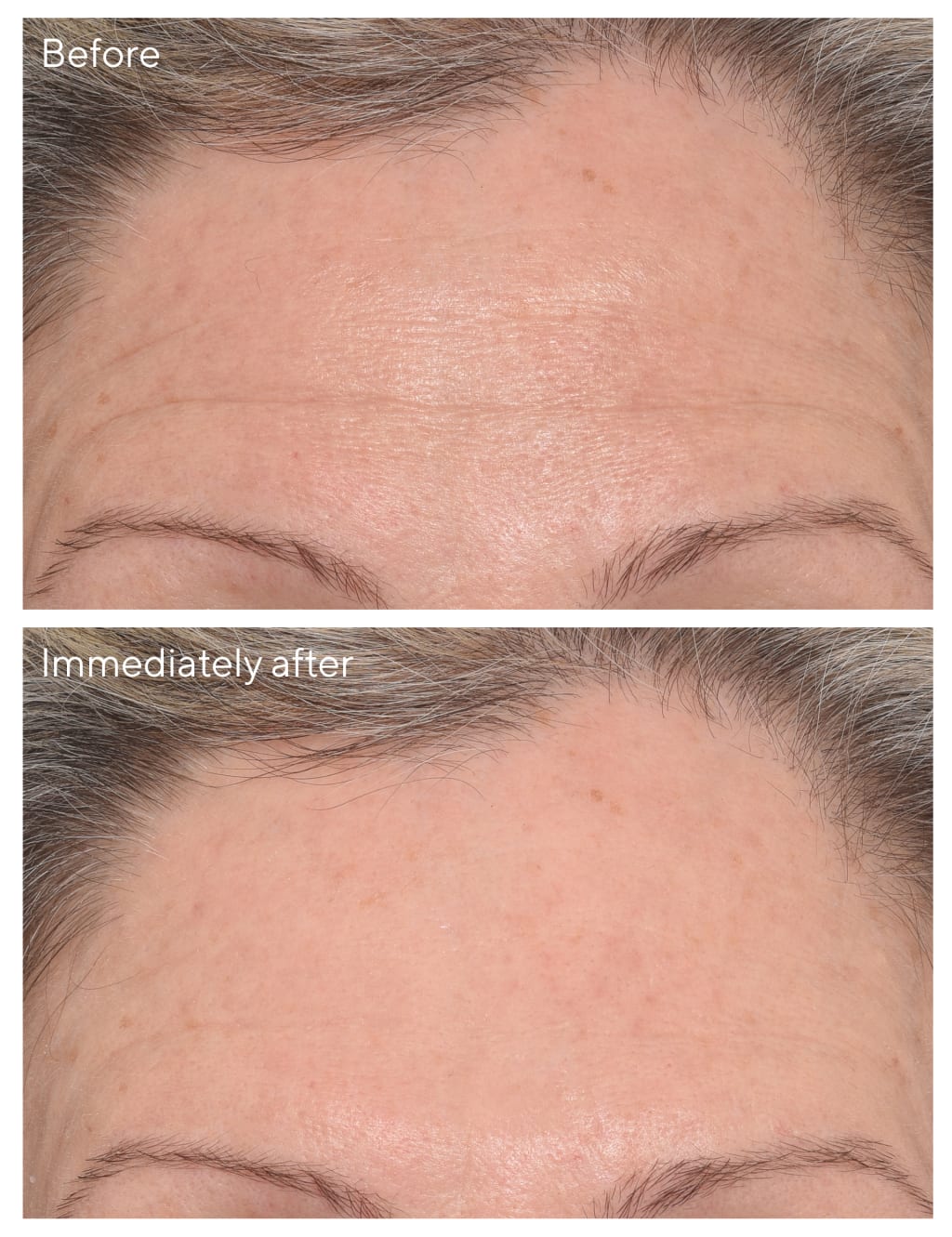 RSG Targeted Wrinkle Corrector 15ml 3 of 6