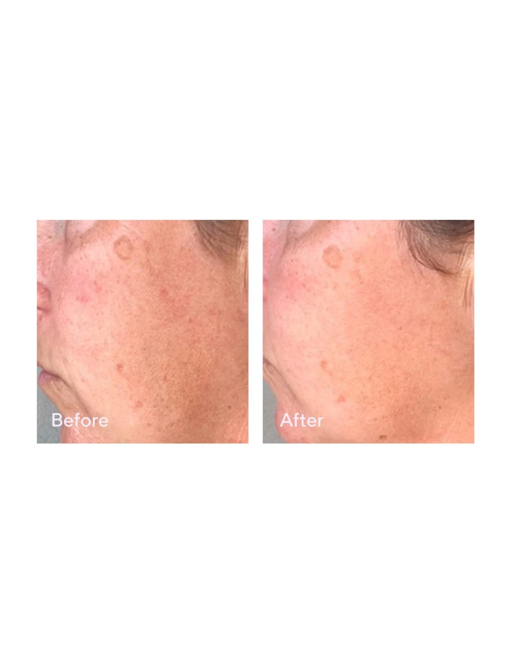 Correct & Protect Broad Spectrum SPF 45 30ml 2 of 6