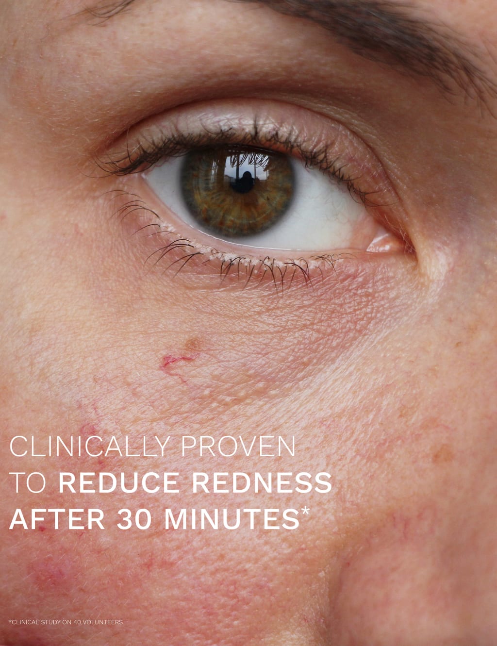 Evercalm™ Redness Relief Serum 30ml 3 of 9