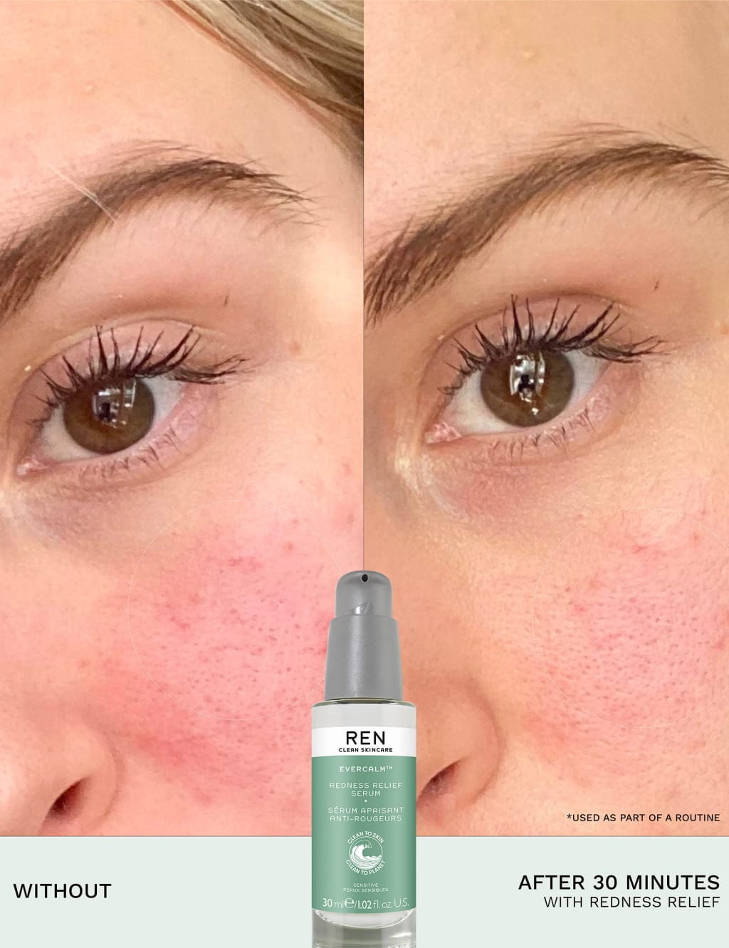 Evercalm™ Redness Relief Serum 30ml 5 of 9