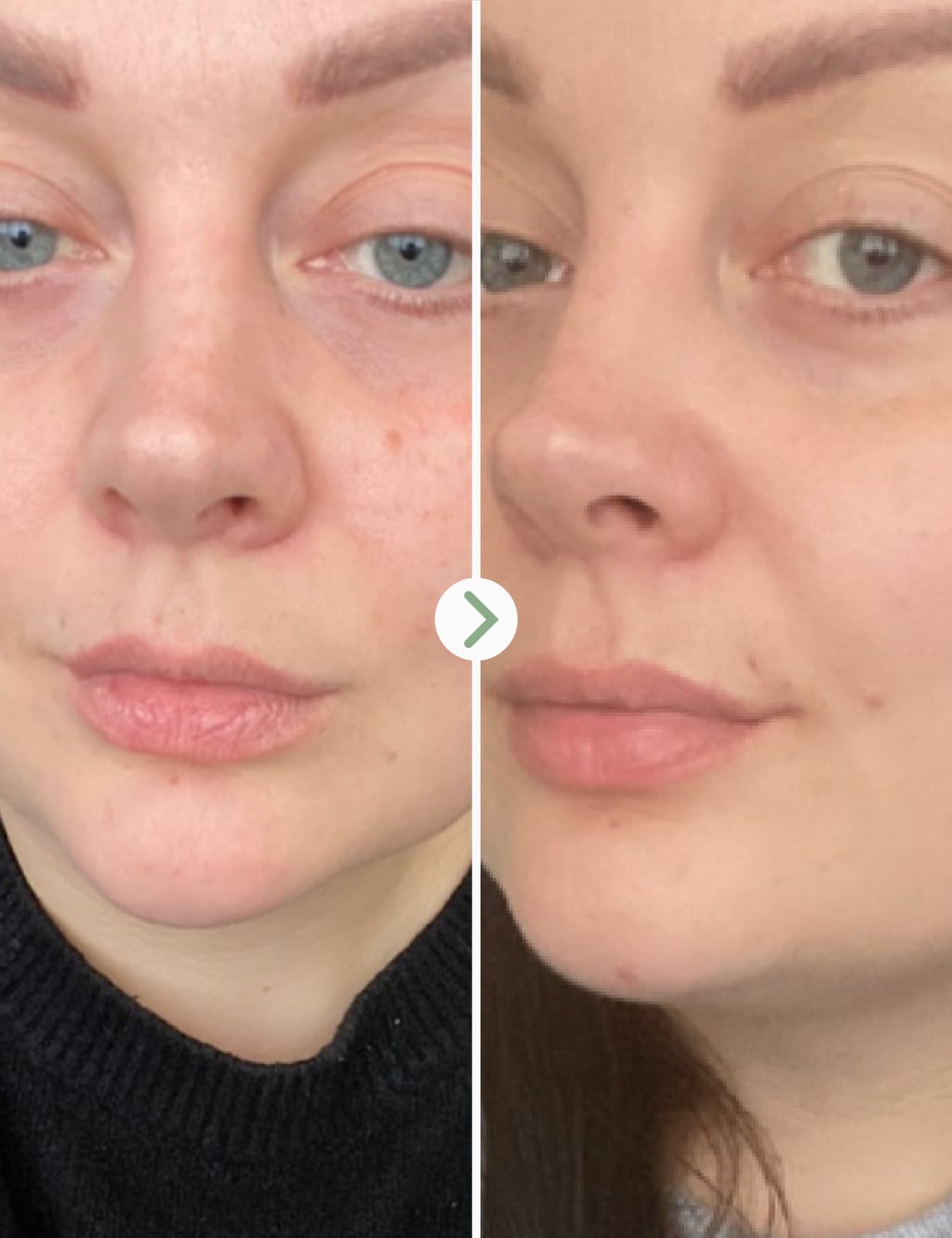 Rosehip Bioregenerate™  Rejuvenating Overnight Face Oil 10ml 5 of 7
