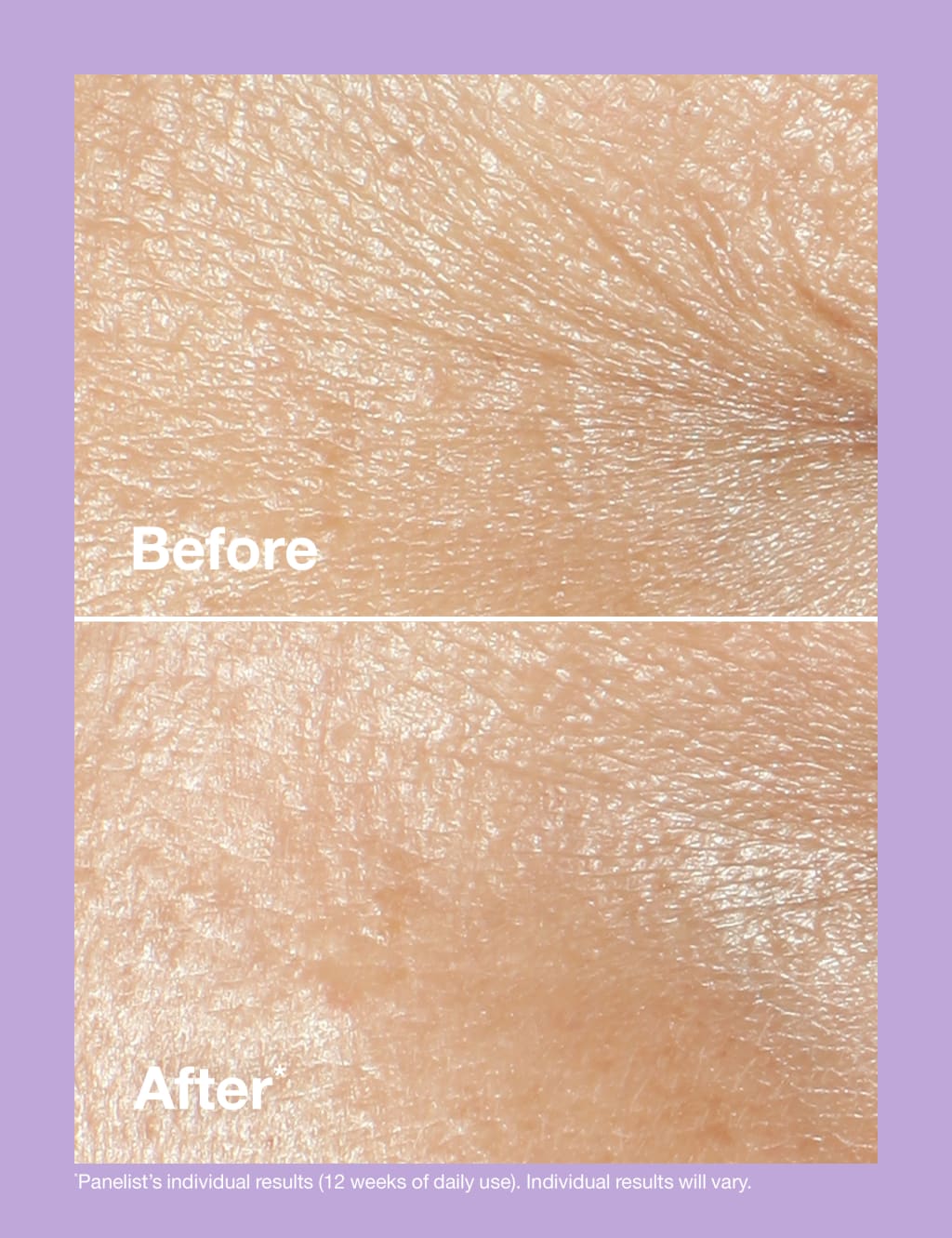 Clinique Smart Clinical Repair™ Wrinkle Correcting Rich Cream 50ml 4 of 9