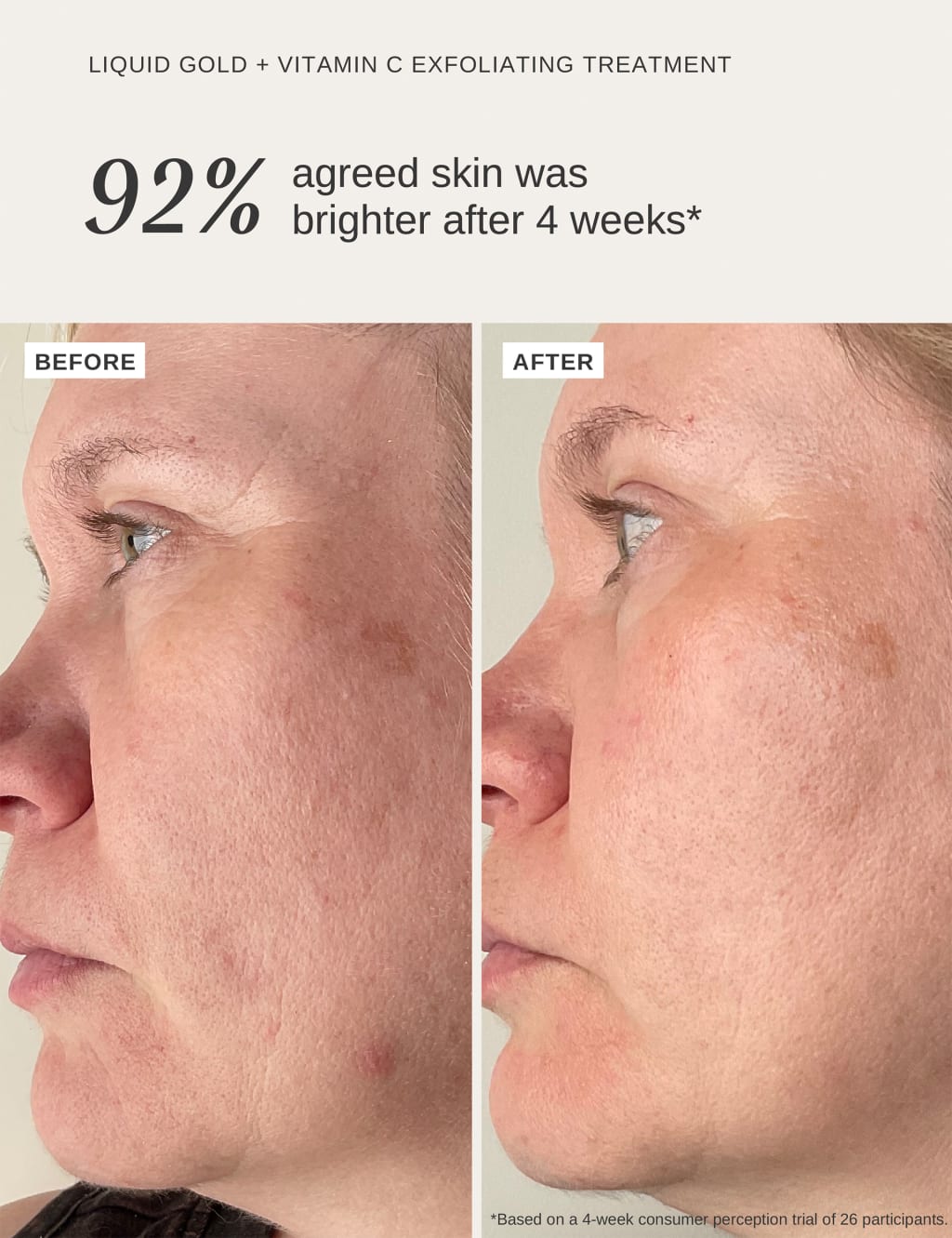 Liquid Gold Exfoliating Treatment with Vitamin C 100ml 4 of 7
