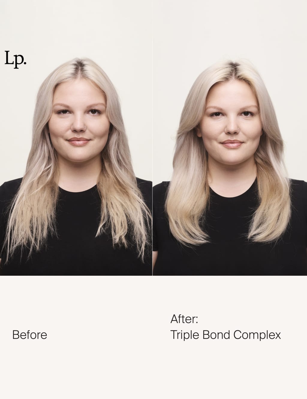 LP Triple Bond Complex 10ml 2 of 5