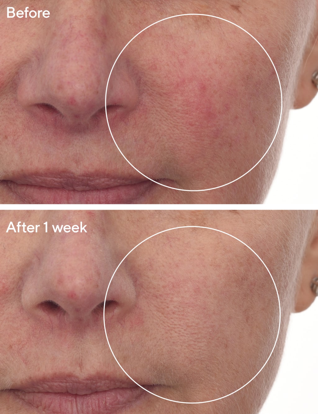 Cellular Hydration Barrier Repair Serum 30ml 3 of 5