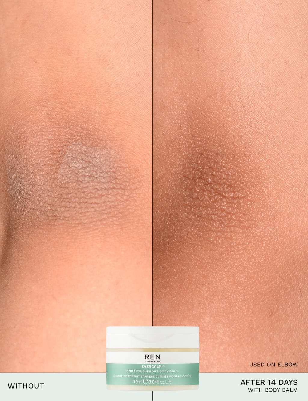 Evercalm™ Barrier Support Body Balm 90ml 9 of 13