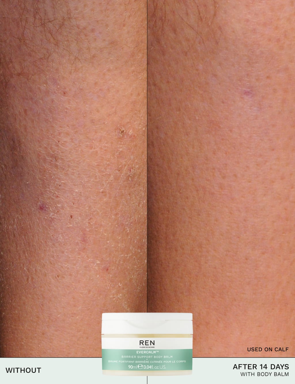 Evercalm™ Barrier Support Body Balm 90ml 11 of 13