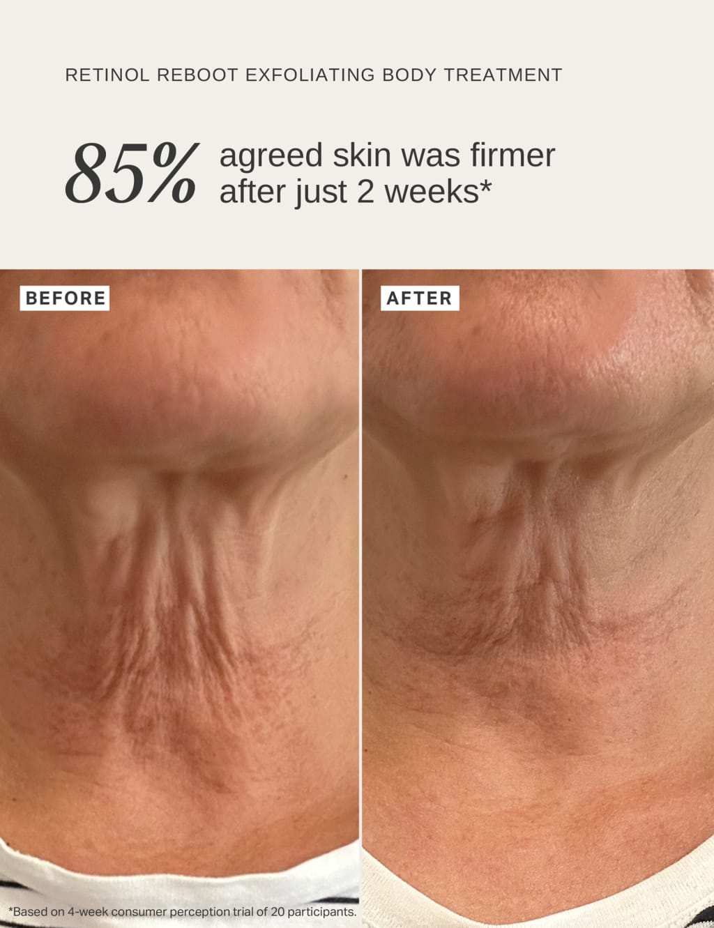 Retinol Reboot Exoliating Body Treatment 120ml 2 of 5