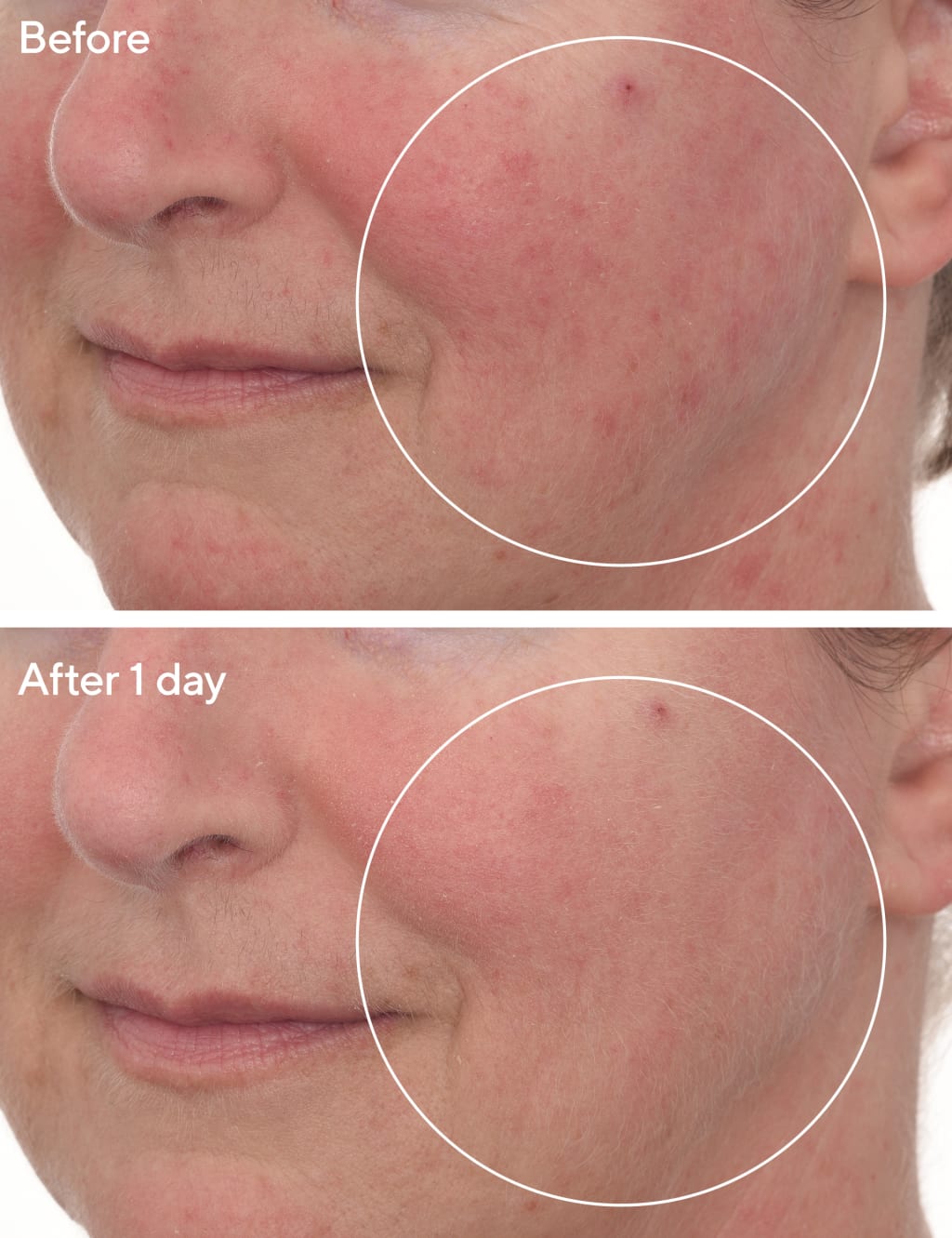 Cellular Hydration Barrier Repair Mask 80ml 3 of 5