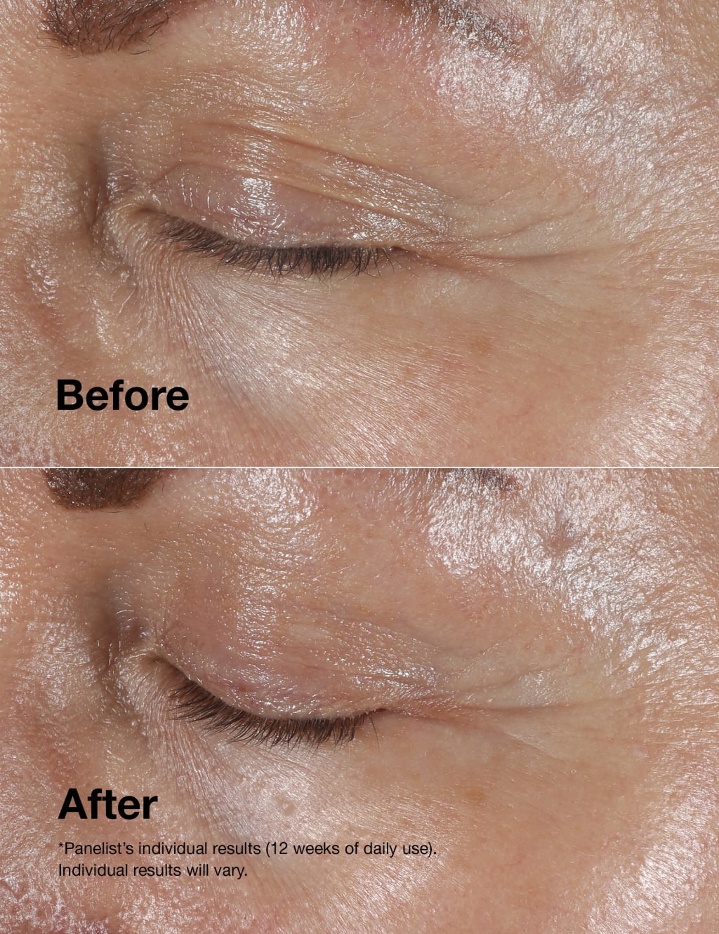 Smart Clinical Repair™ Wrinkle Correcting Eye Cream 15ml 3 of 7