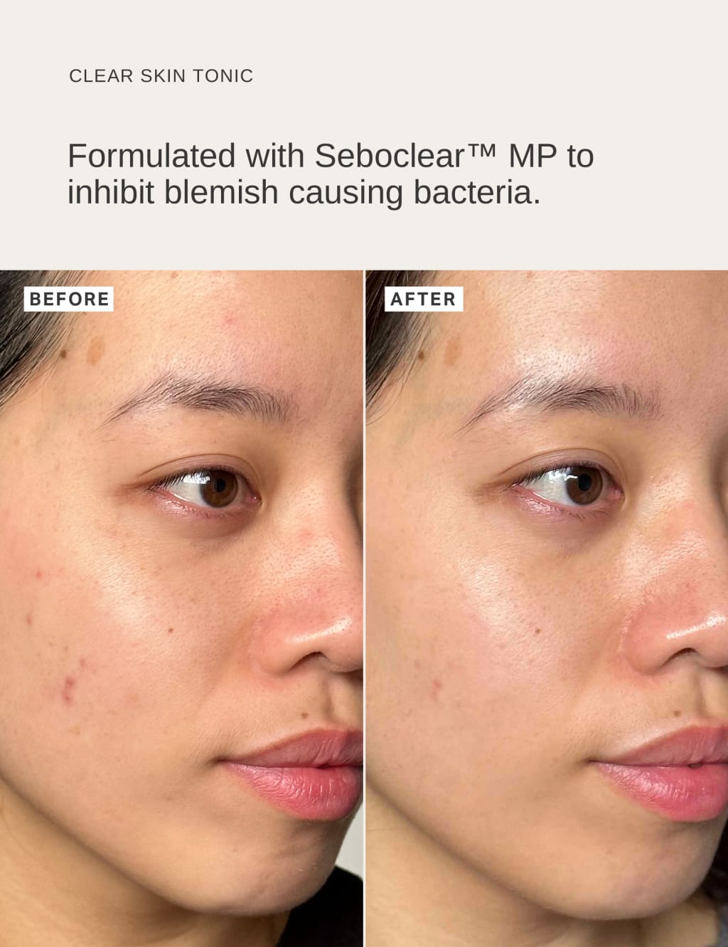 Clear Skin Tonic with 2% Salicylic Acid 100ml 2 of 7