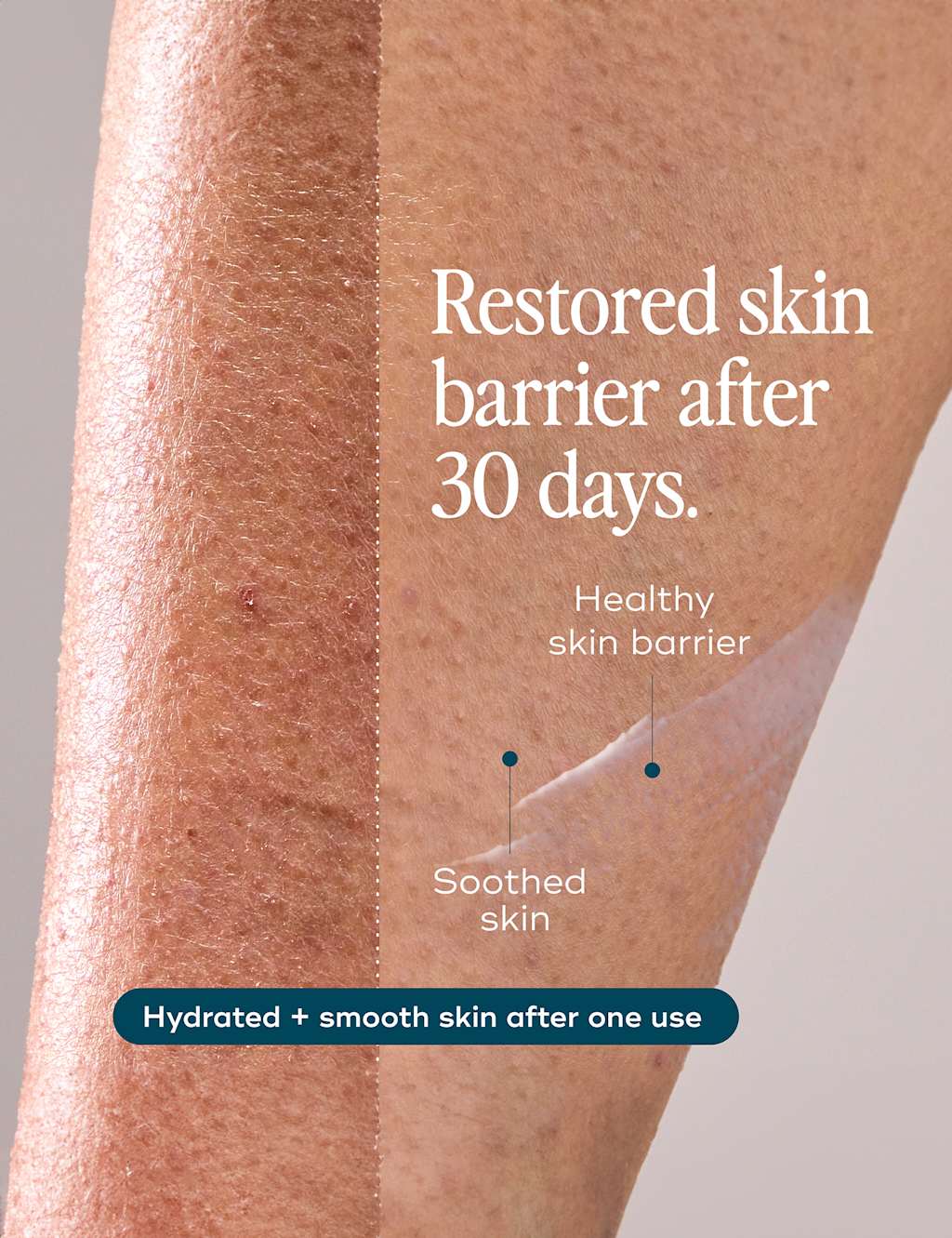 The Everywhere Lotion for Dry Skin 200ml 6 of 8