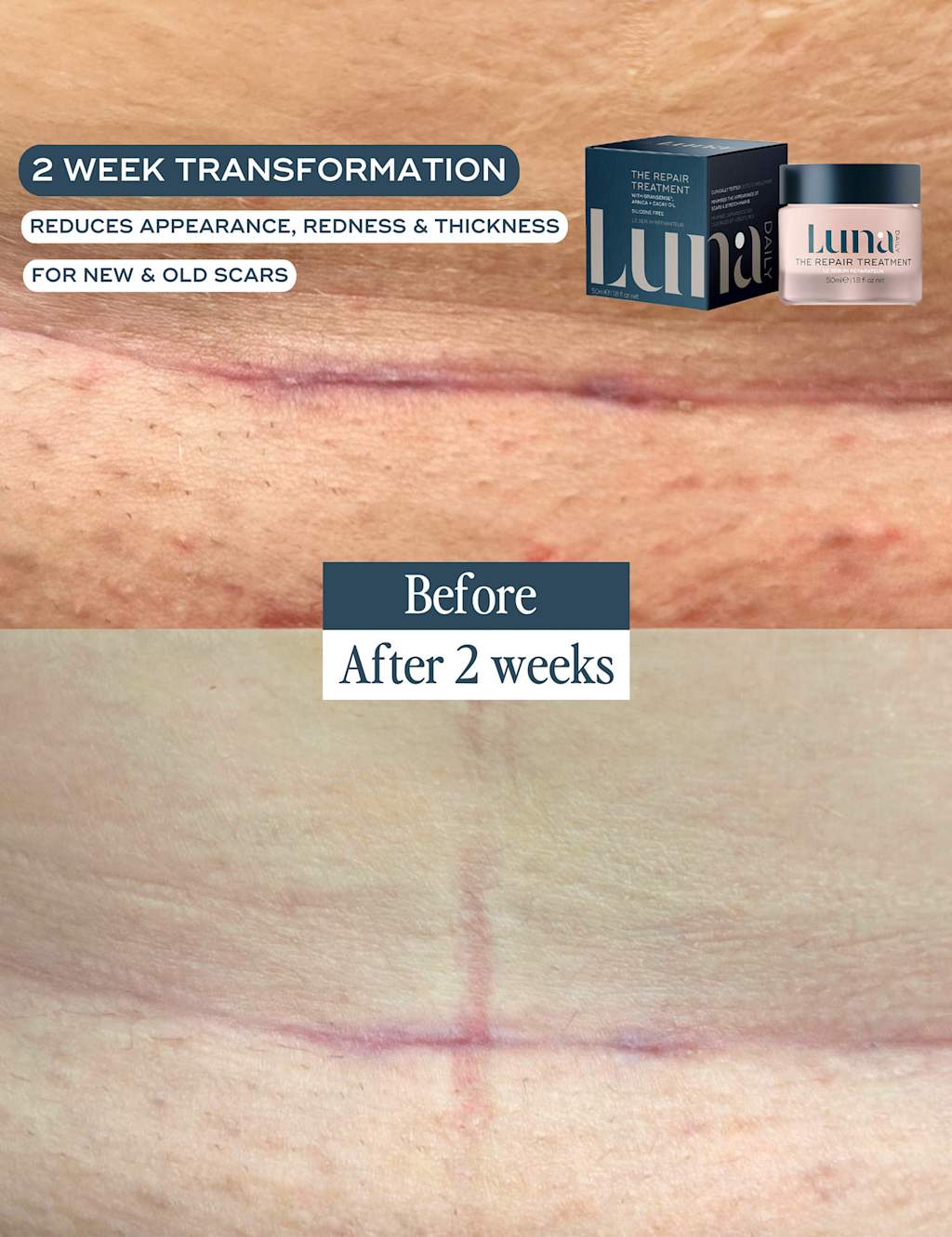 The Repair Treatment for Scars 50ml 4 of 9