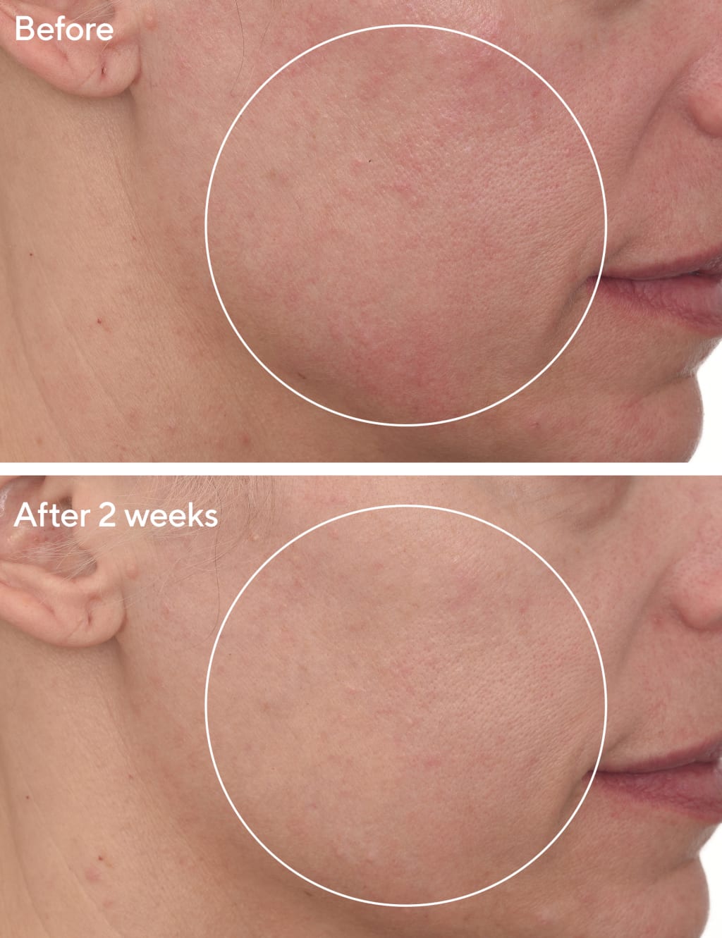 Cellular Hydration Barrier Repair Cream 50ml 3 of 5