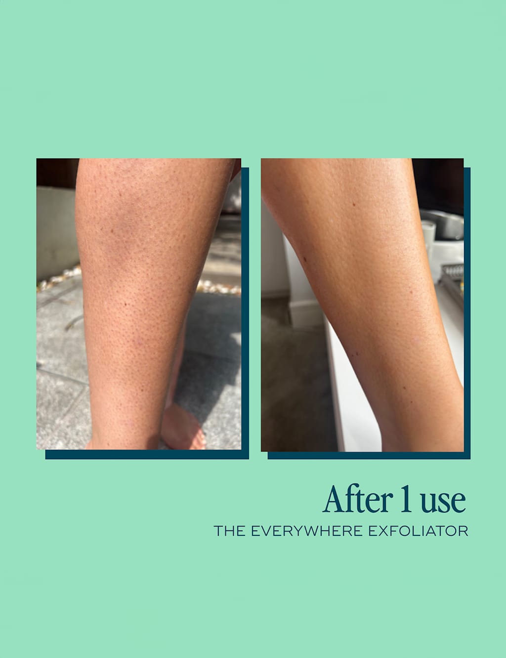 The Everywhere Exfoliator for KP 180ml 6 of 8