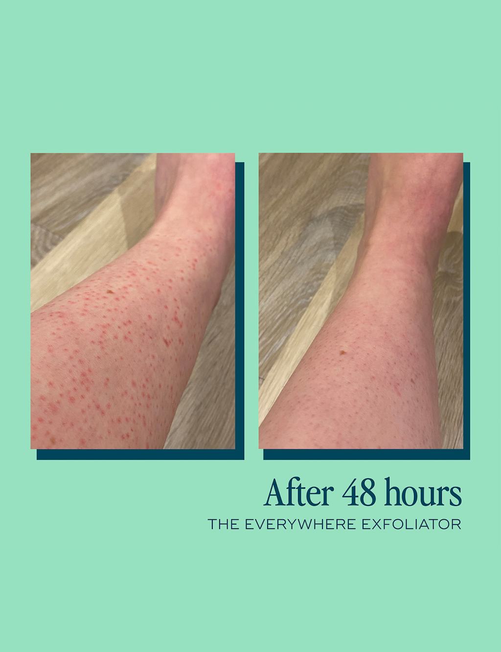 The Everywhere Exfoliator for KP 180ml 7 of 8