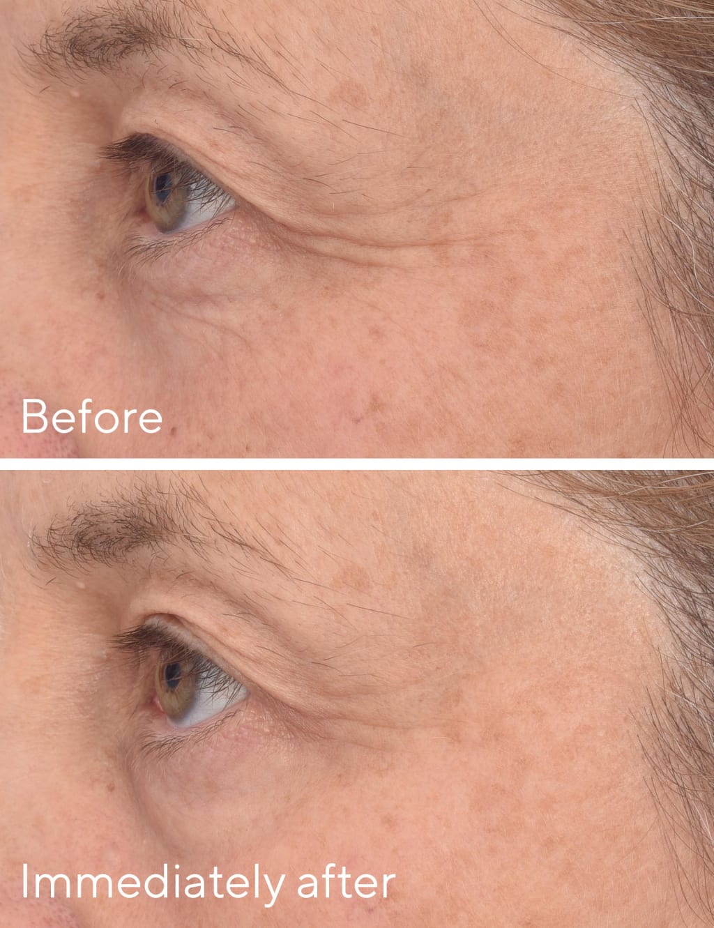 Retinol Youth Renewal Eye Masks 4 of 7