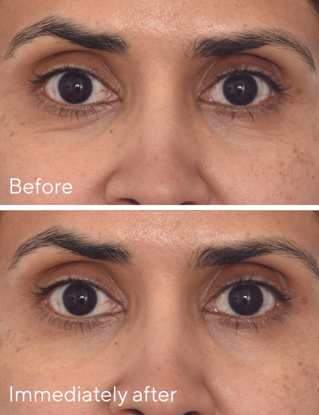Retinol Youth Renewal Eye Masks 5 of 7