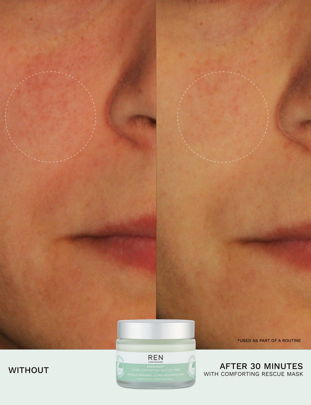 Evercalm™ Ultra Comforting Rescue Mask 50ml 6 of 11