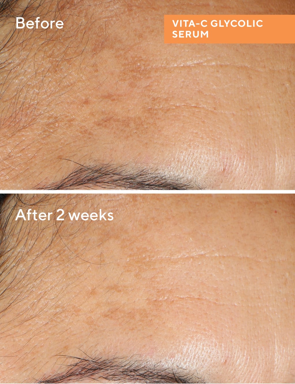 Vita-C Glycolic Brightening Serum 30ml 3 of 6