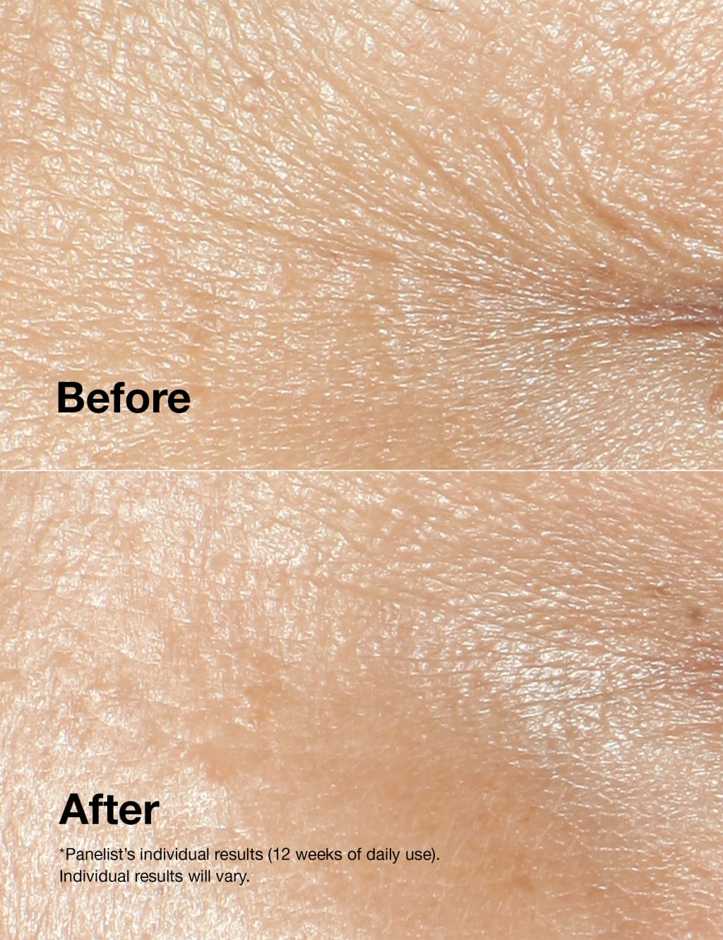Clinique Smart Clinical Repair™ Wrinkle Correcting Cream 50ml 3 of 6