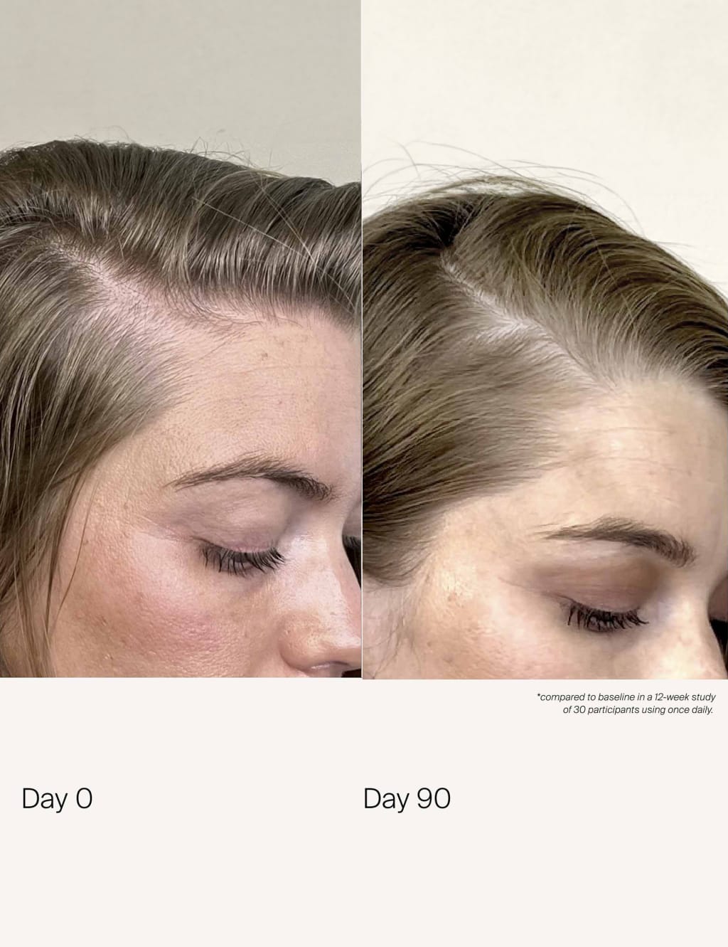 Scalp Care Density Serum 50ml 6 of 10
