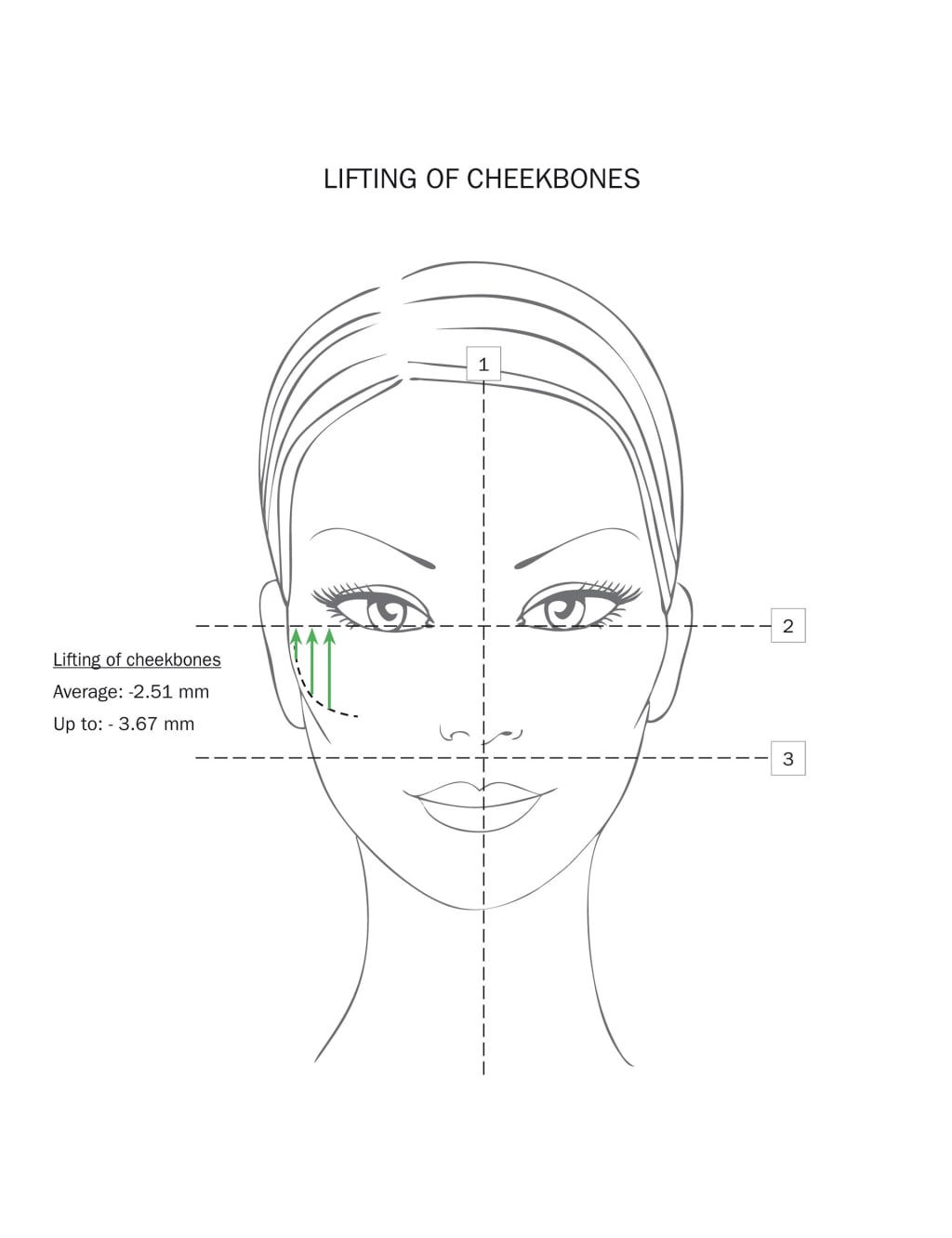 Lip Volume Grade2 5ml 4 of 5