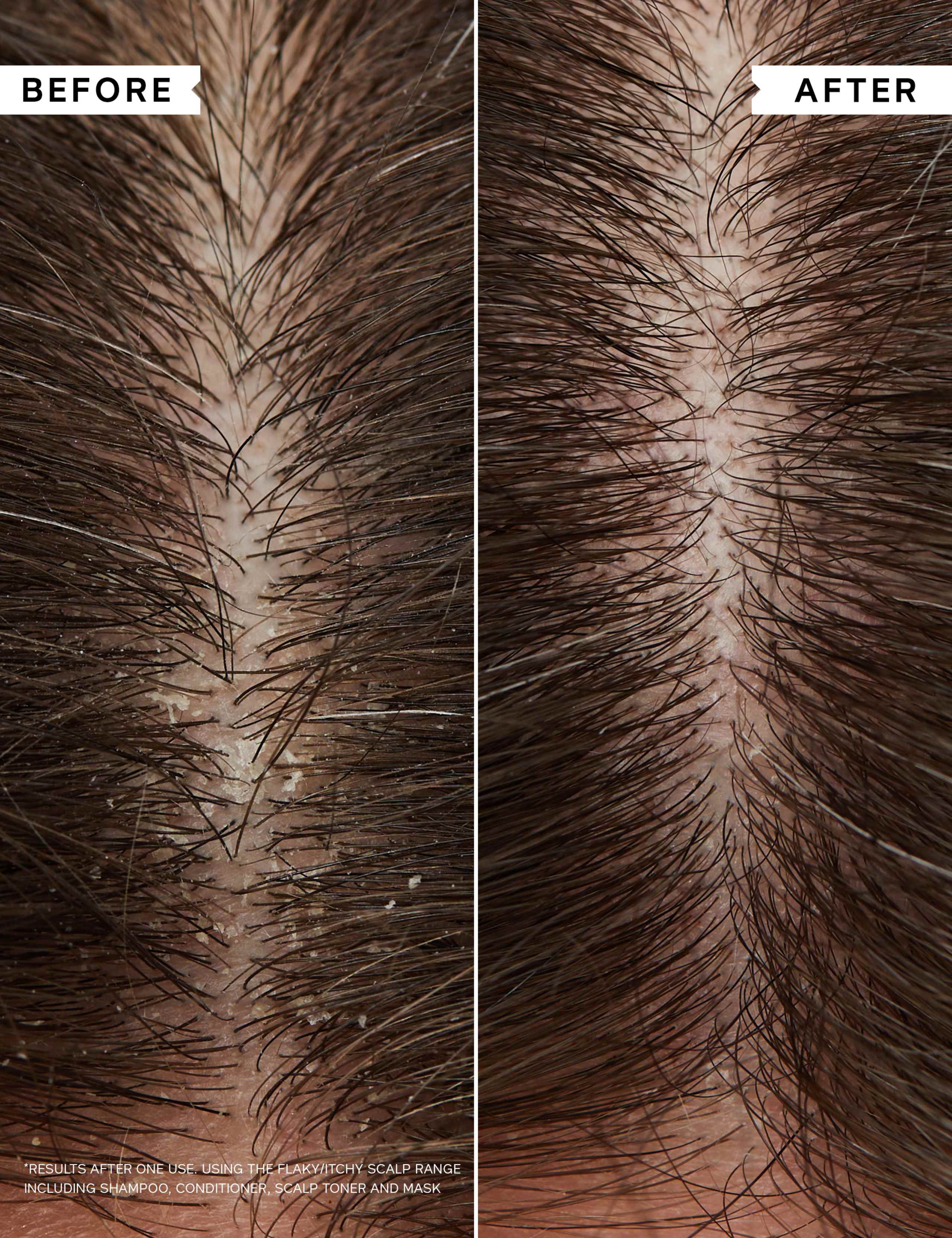 Philip Kingsley Flaky/Itchy Scalp Hydrating Curl Anti-Dandruff Shampoo 500ml 3 of 7