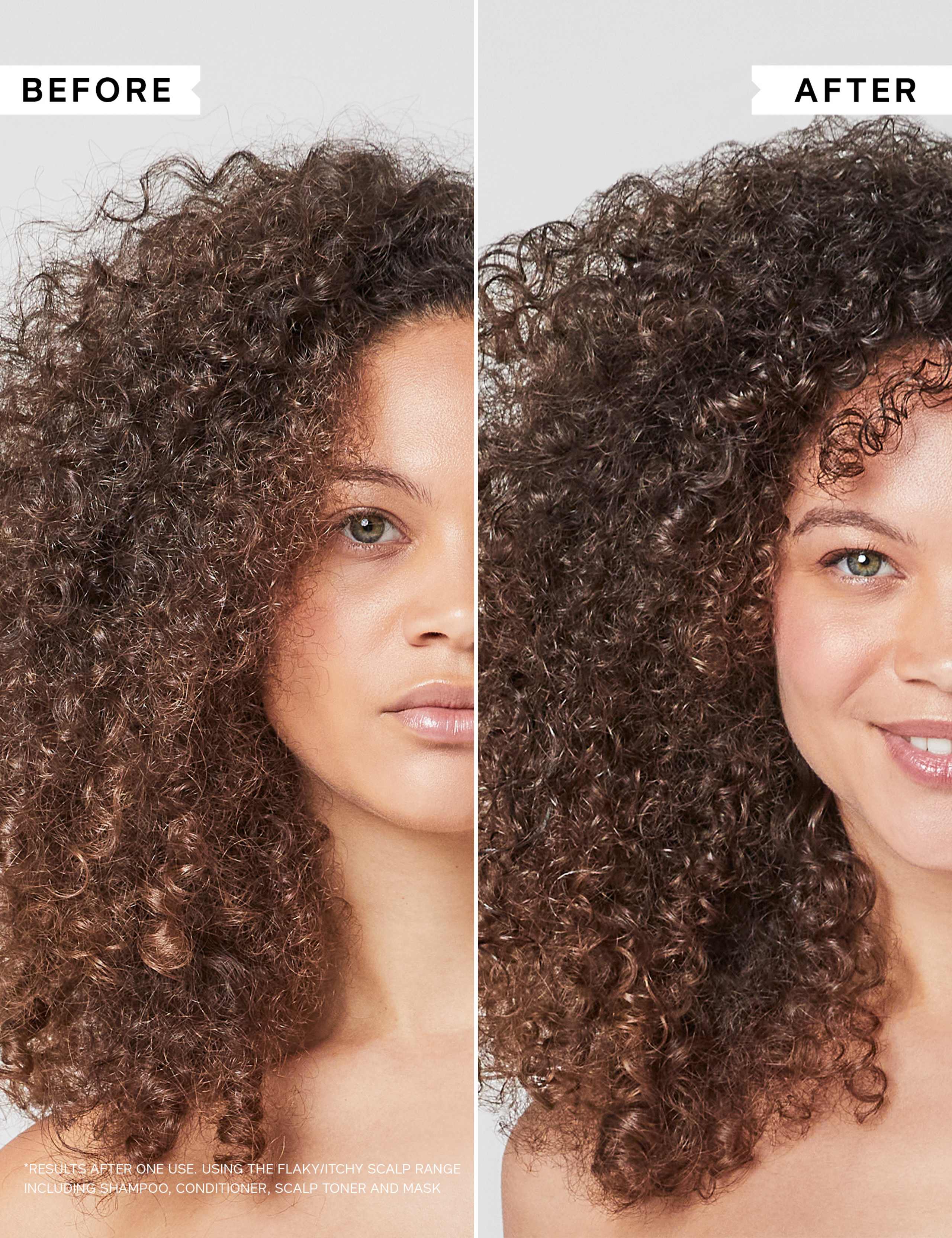 Philip Kingsley Flaky/Itchy Scalp Hydrating Curl Anti-Dandruff Shampoo 500ml 4 of 7