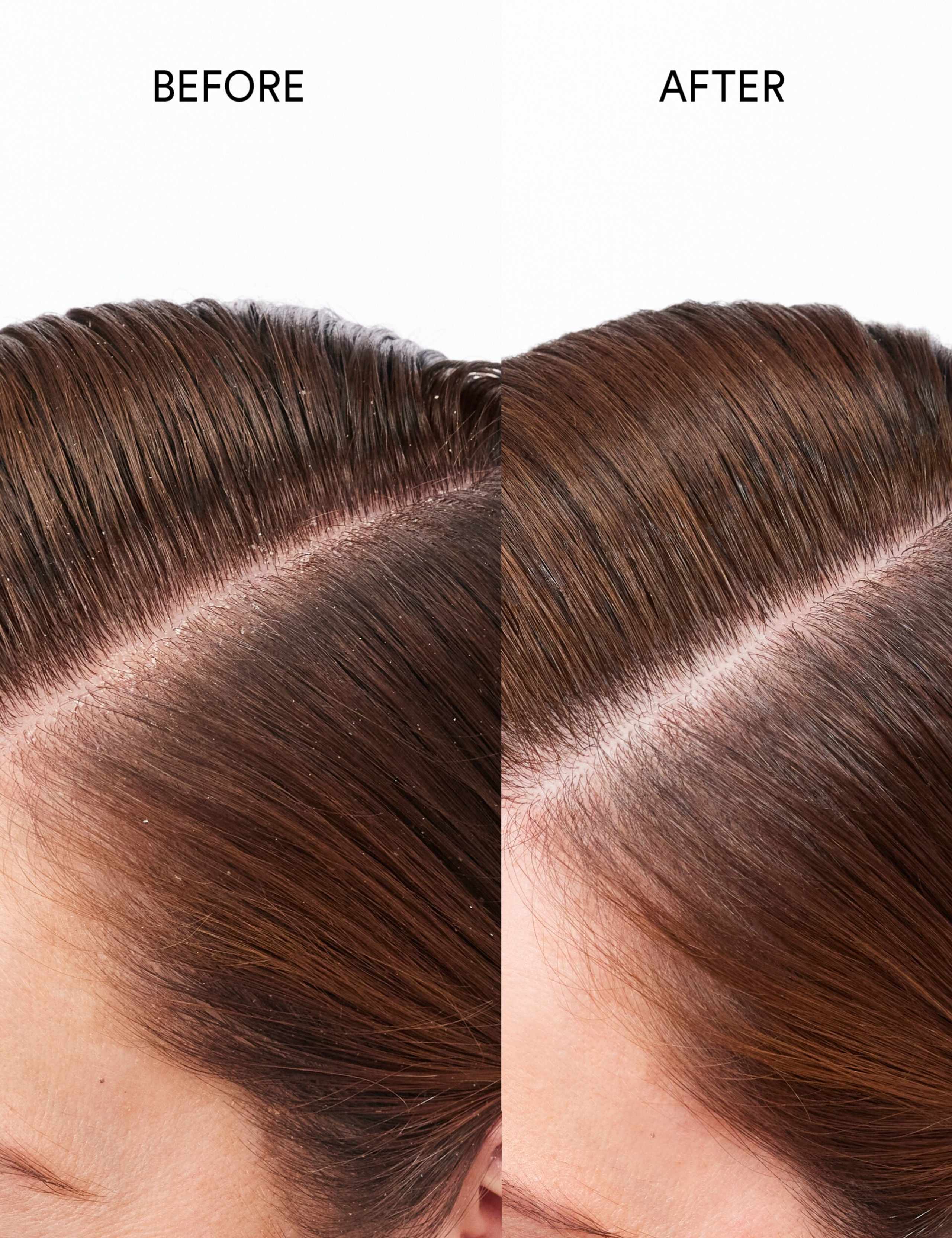 Pure Genius 98% Natural Scalp Restoring Oil 30ml 5 of 6