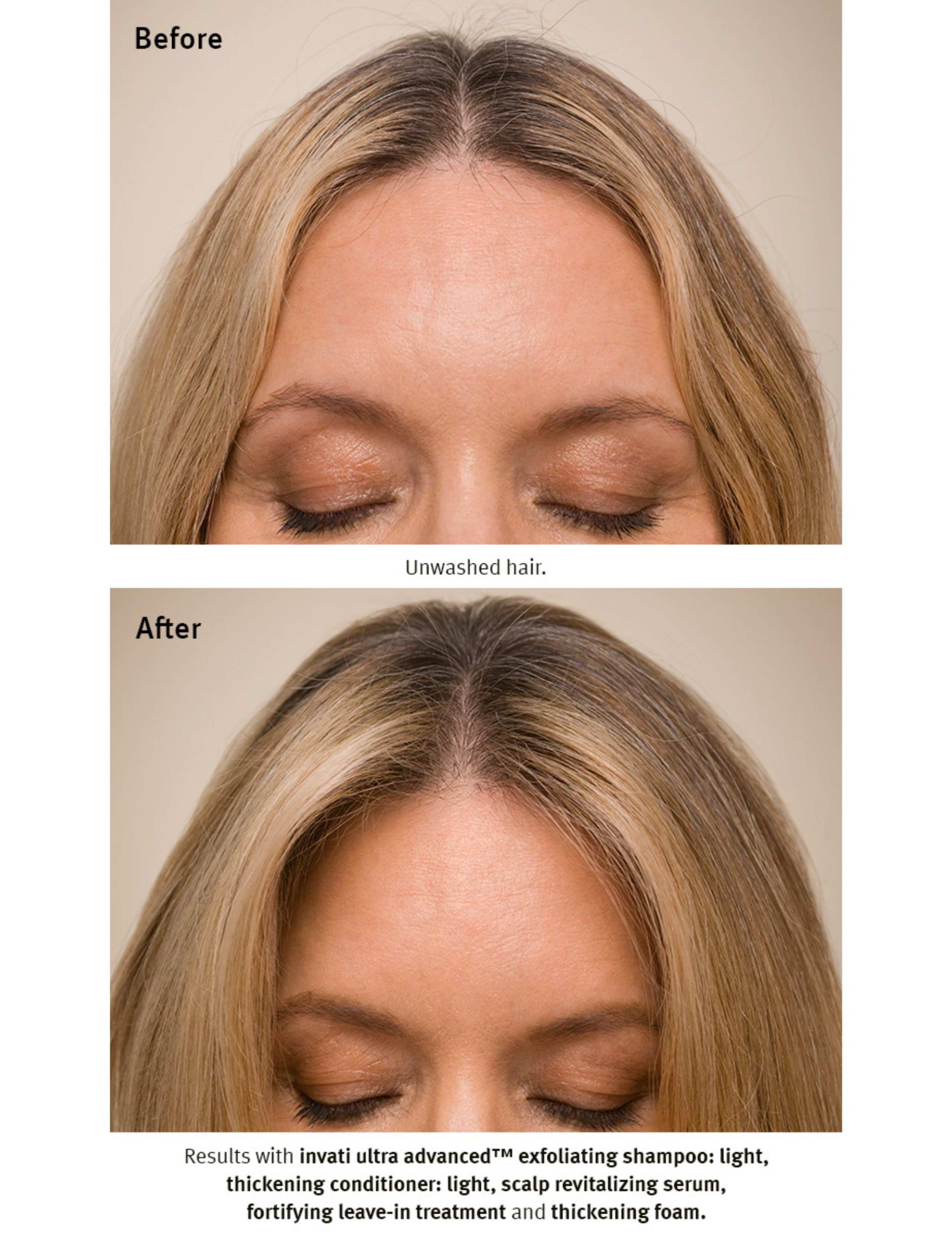 Invati Ultra Advanced™ Thickening Conditioner - Light 200ml 3 of 7