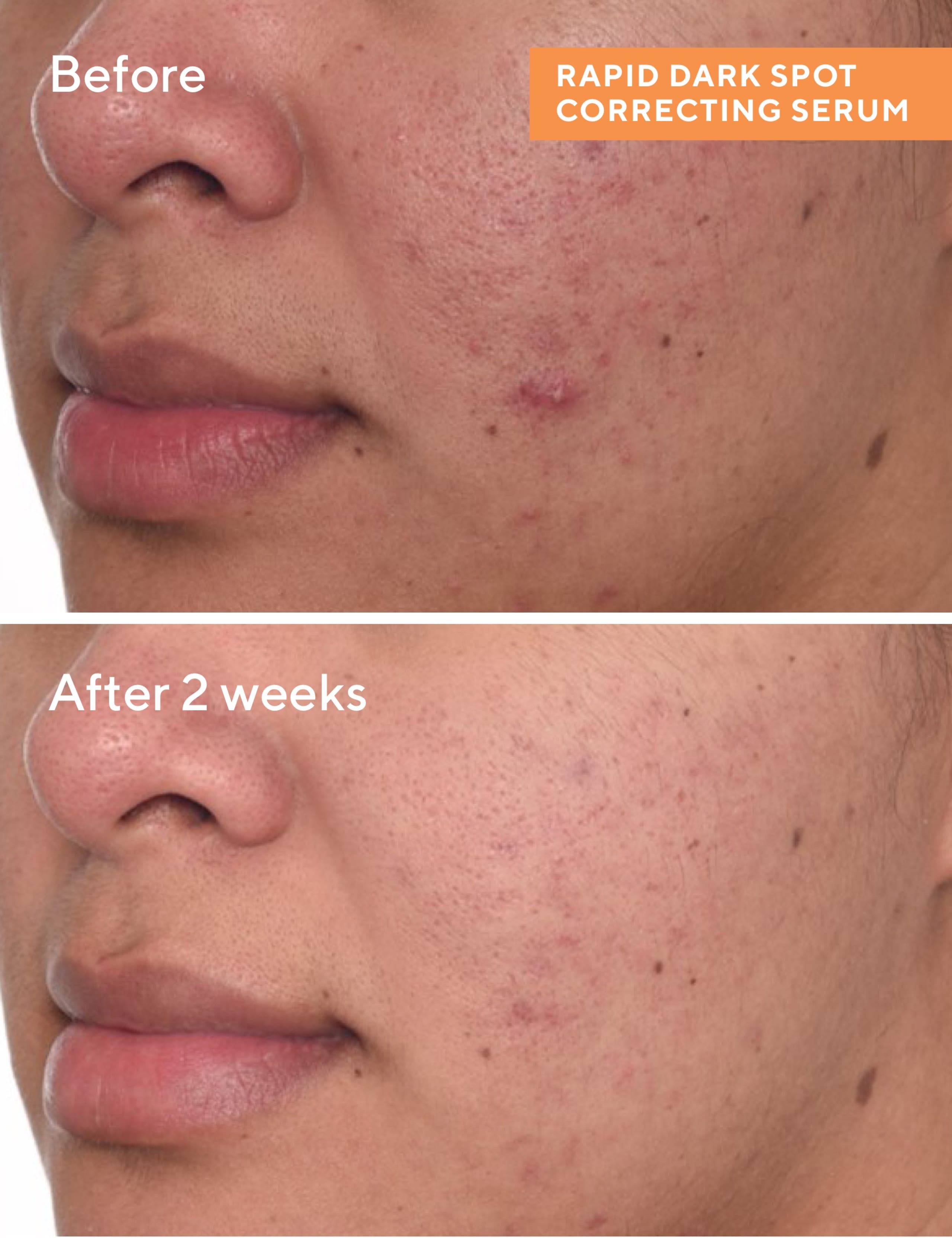 Rapid Dark Spot Correcting Serum 30ml 4 of 8