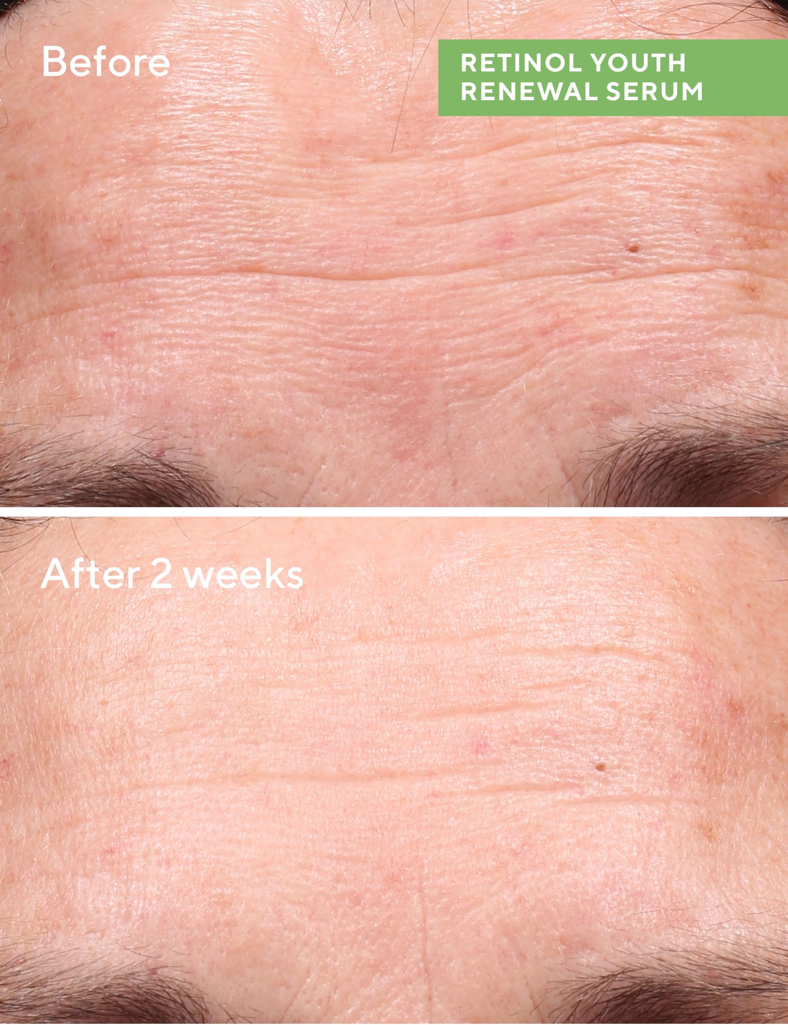Retinol Youth Renewal Serum 30ml 4 of 8