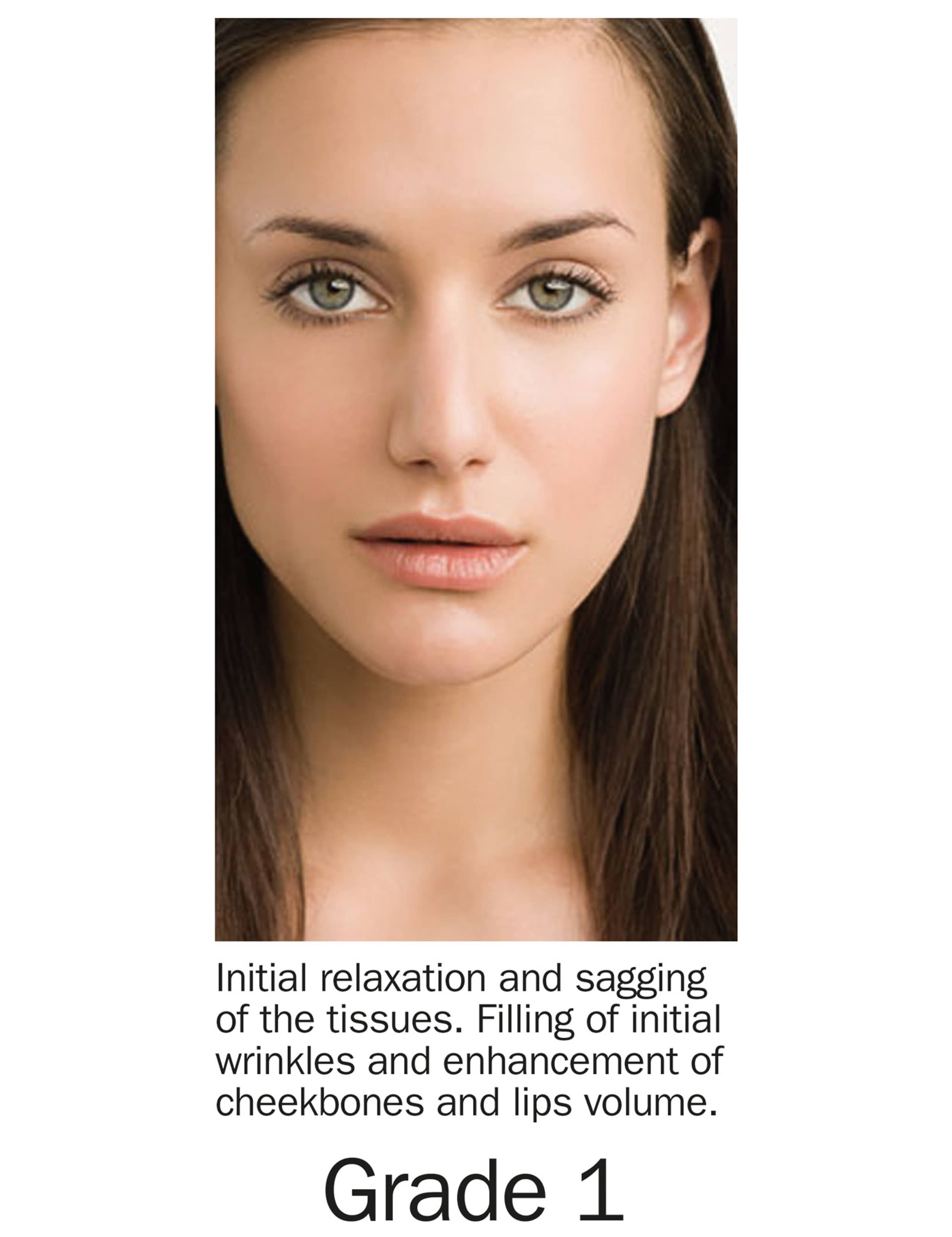 Grade 1 Filler Gel Treatment Kit 3 of 7
