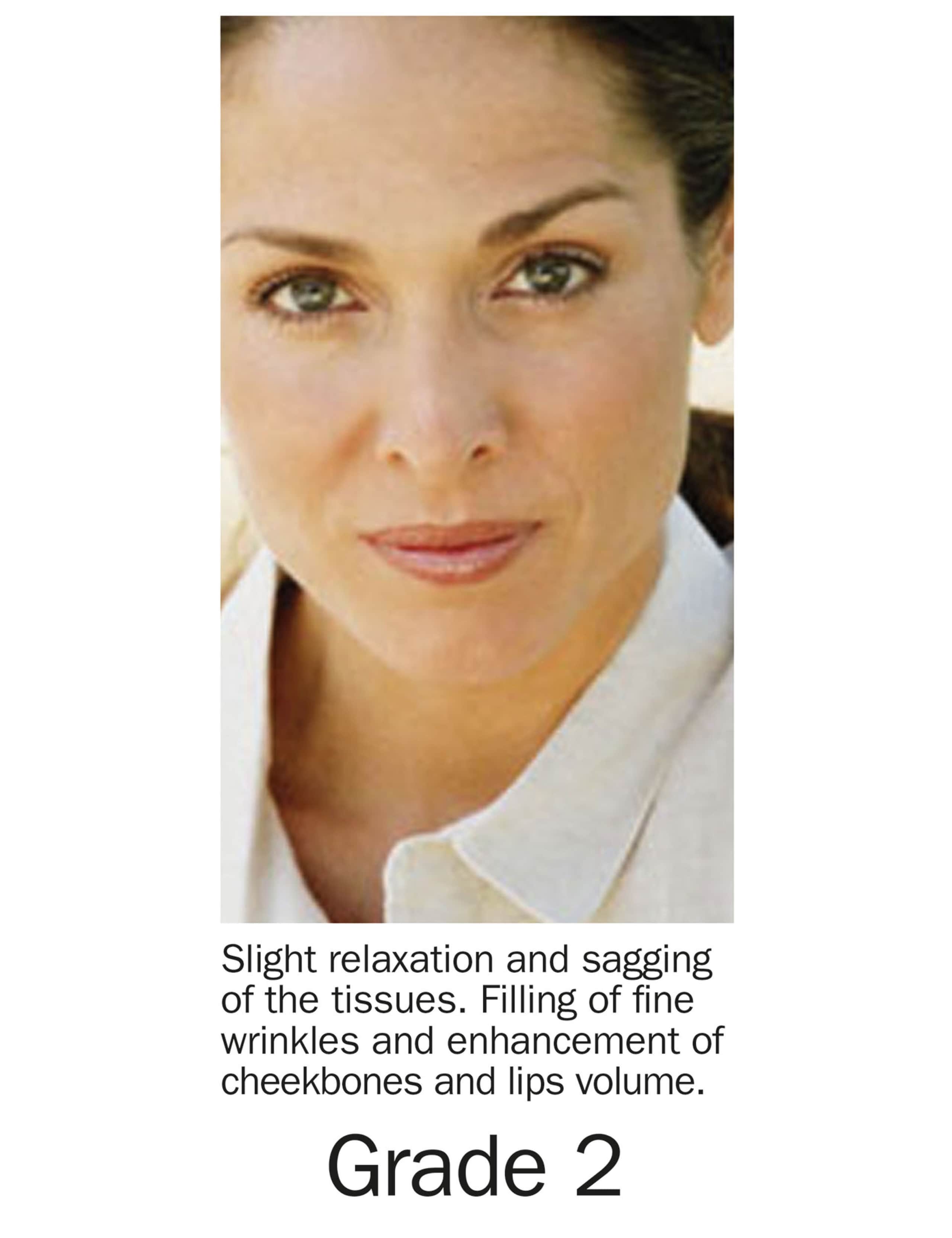 Grade 2 Filler Gel Treatment Kit 4 of 7