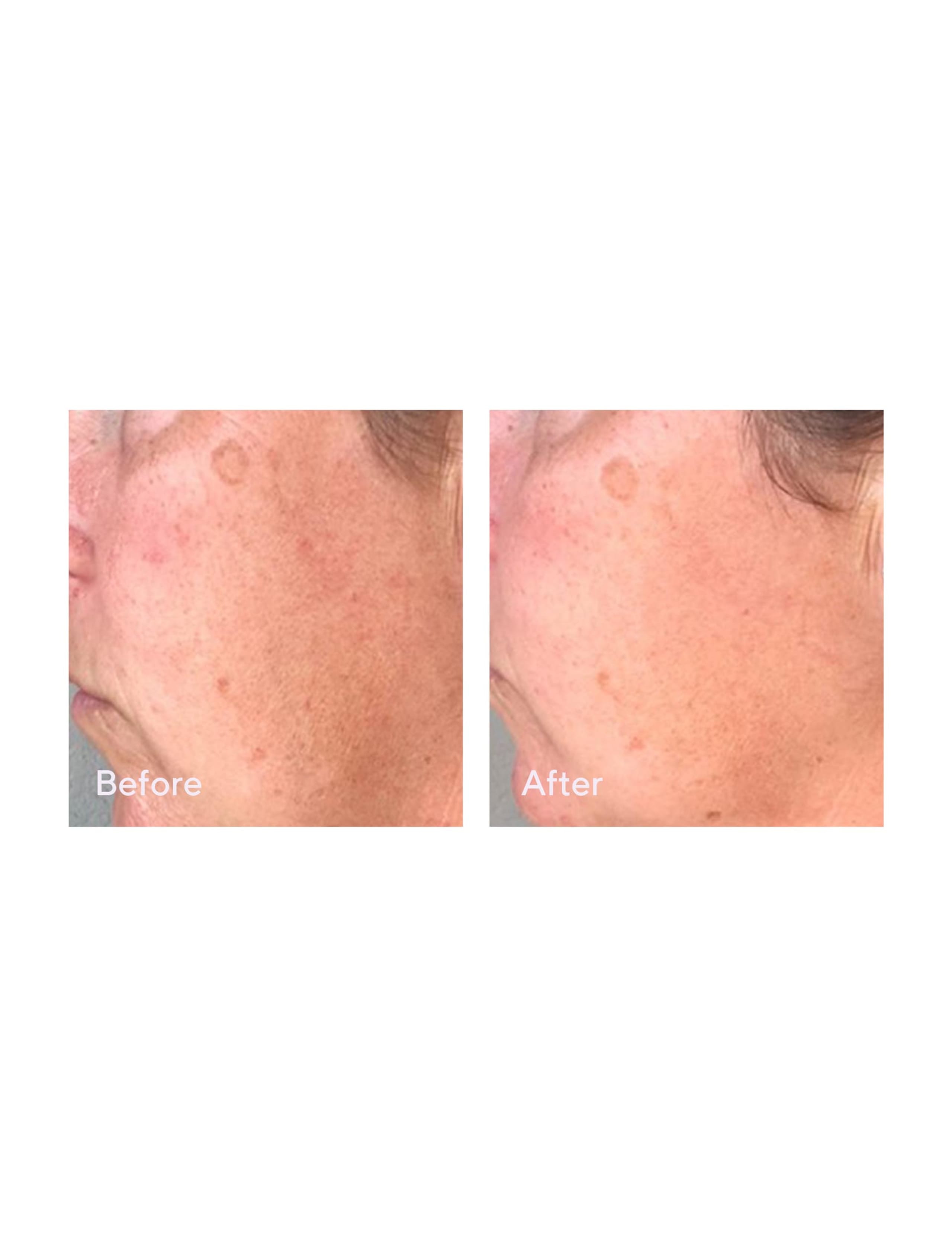 Correct & Protect Broad Spectrum SPF 45 30ml 2 of 6