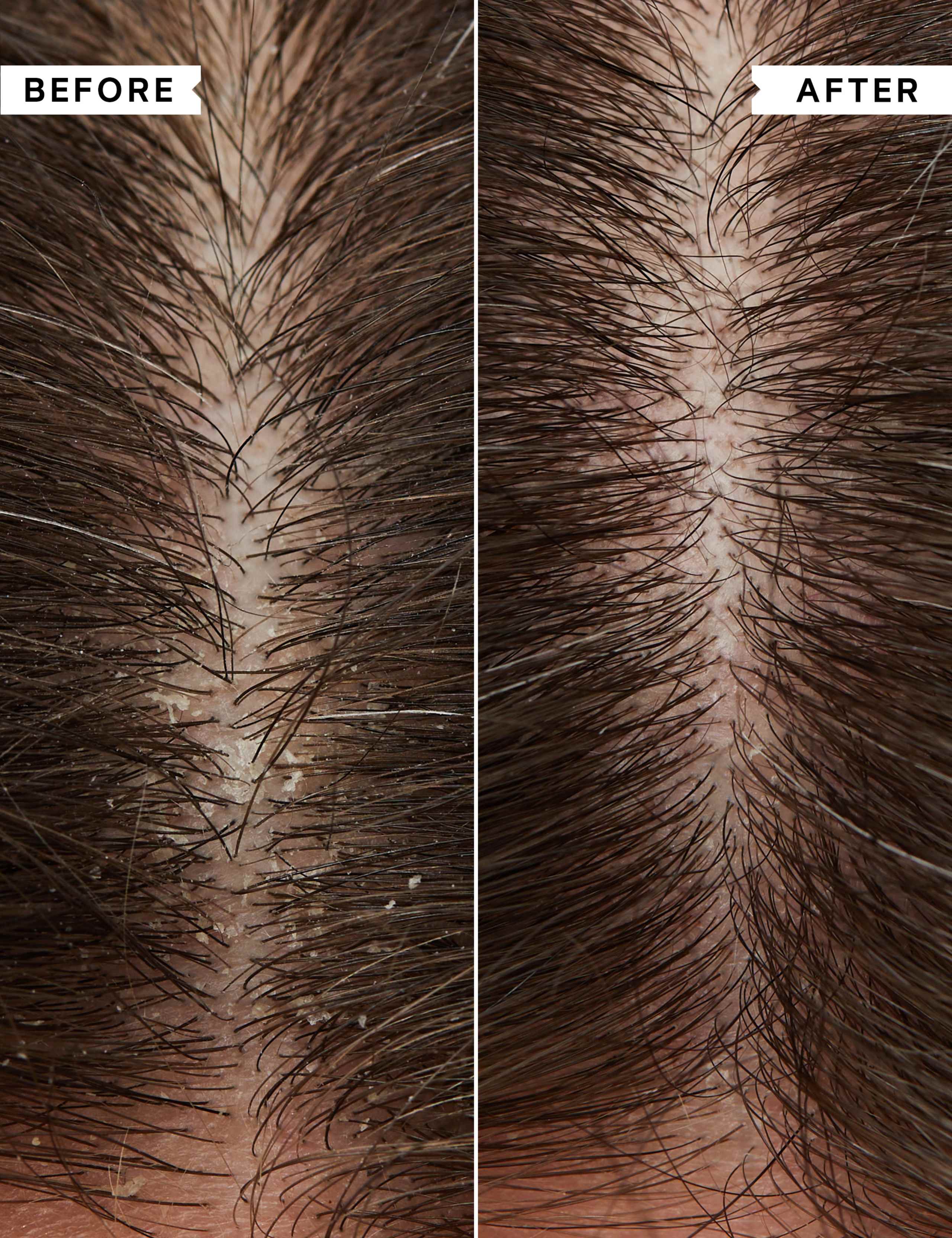 Flaky Itchy Scalp Shampoo 250ml 4 of 8