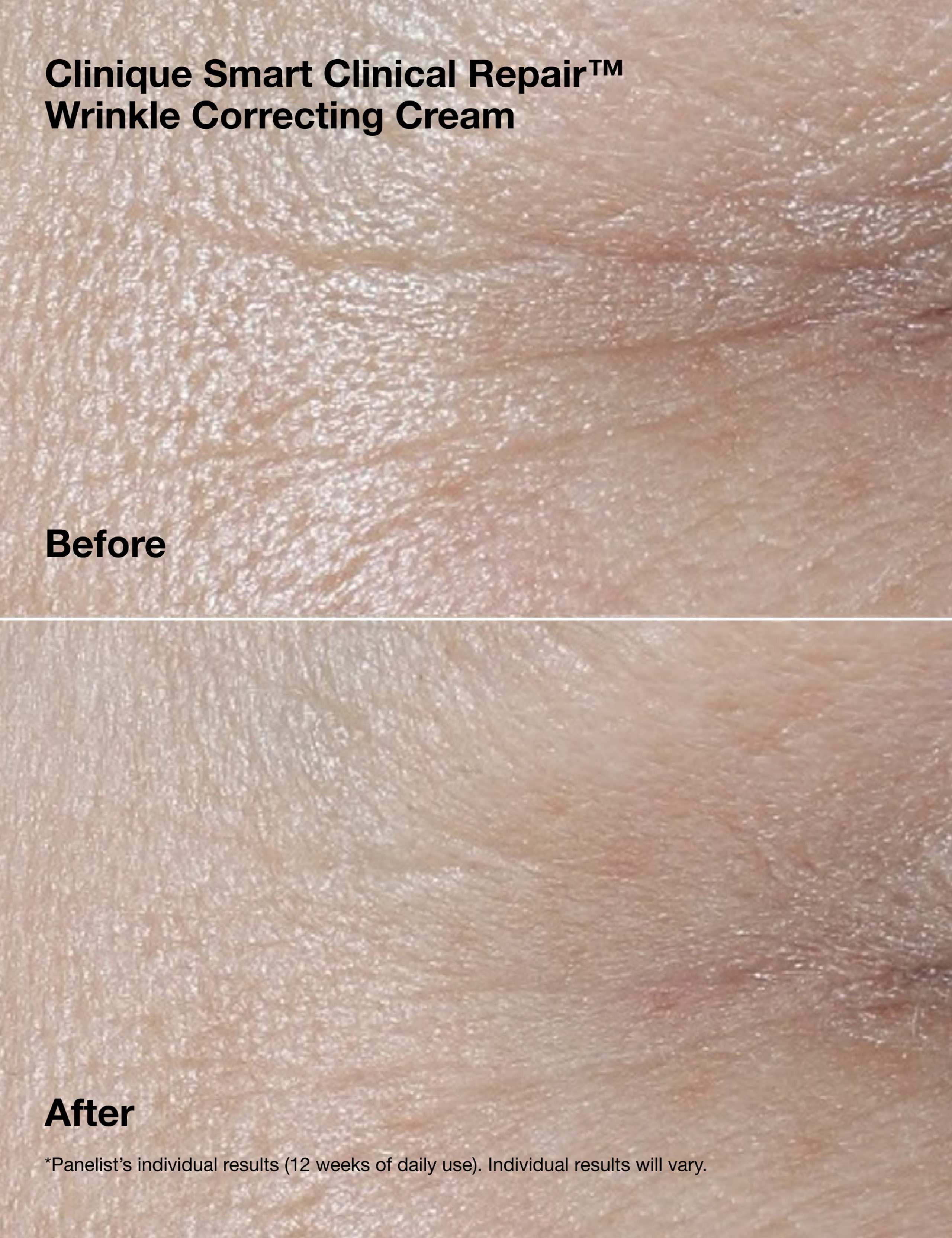 Smart Clinical Repair™ Wrinkle Correcting Cream Gift Set 6 of 9