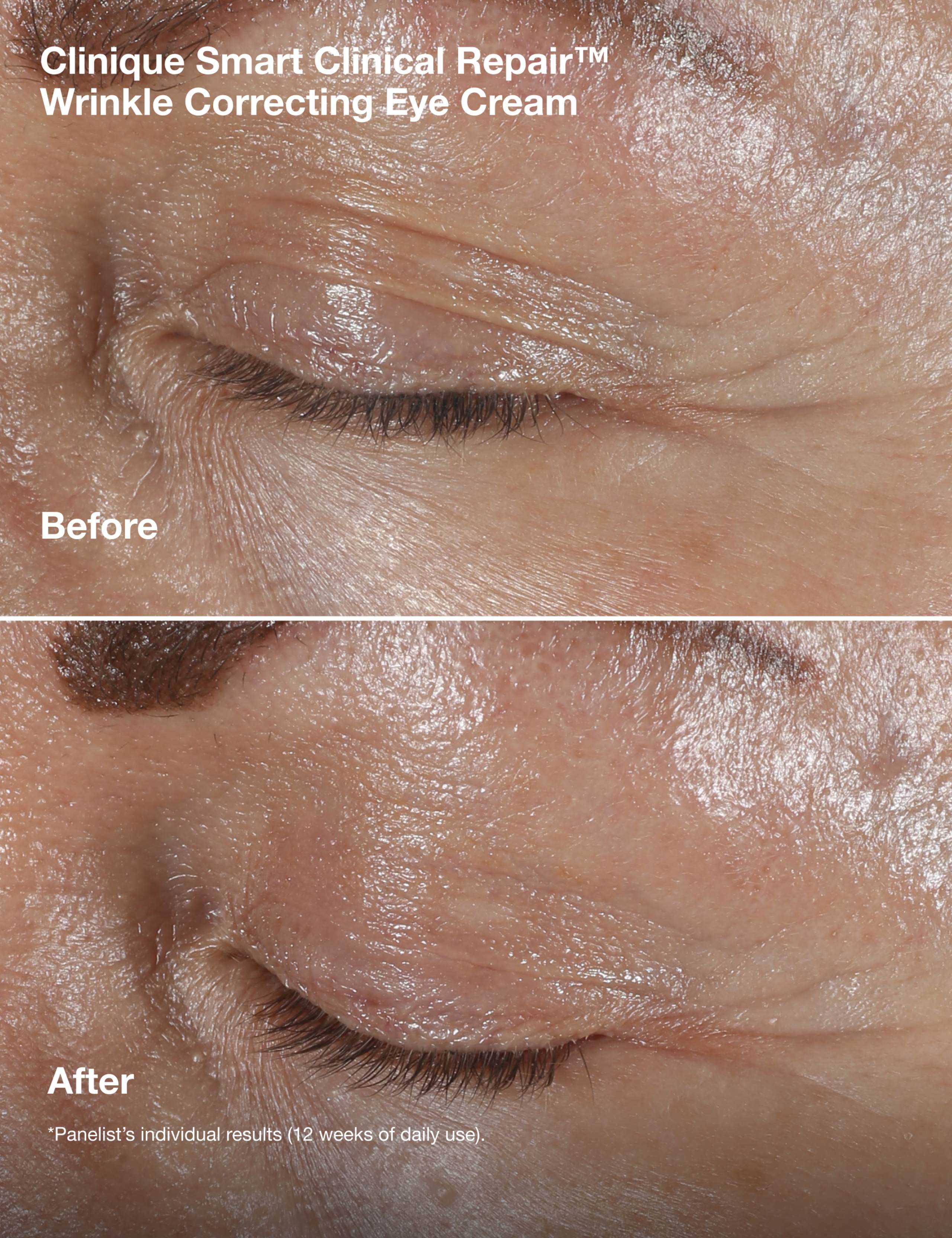 Smart Clinical Repair™ Wrinkle Correcting Cream Gift Set 7 of 9