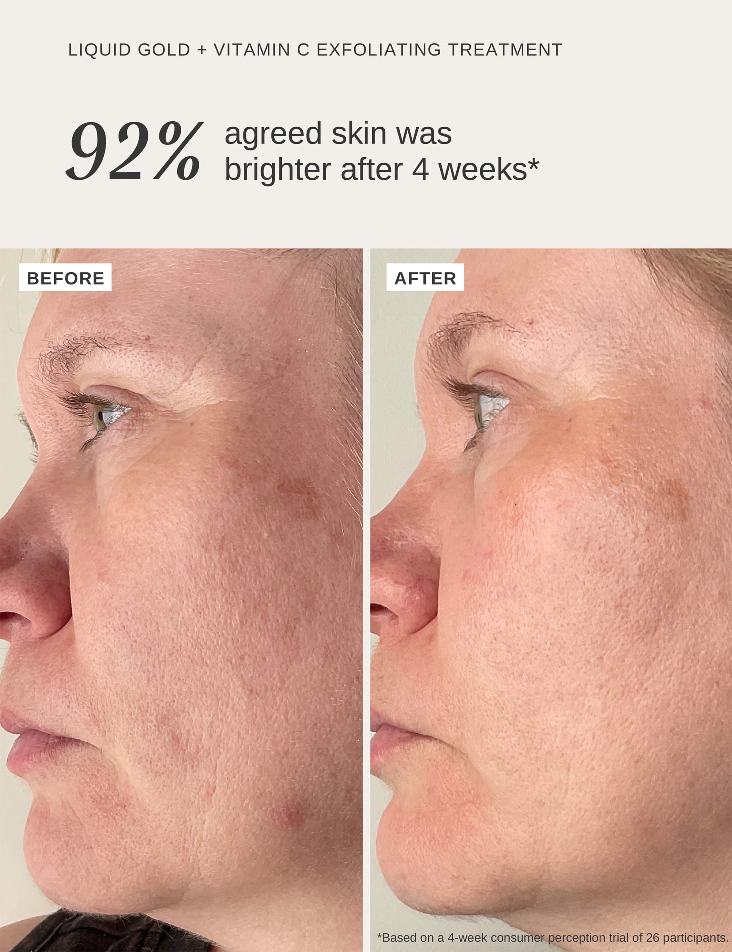 Liquid Gold Exfoliating Treatment with Vitamin C 100ml 4 of 7