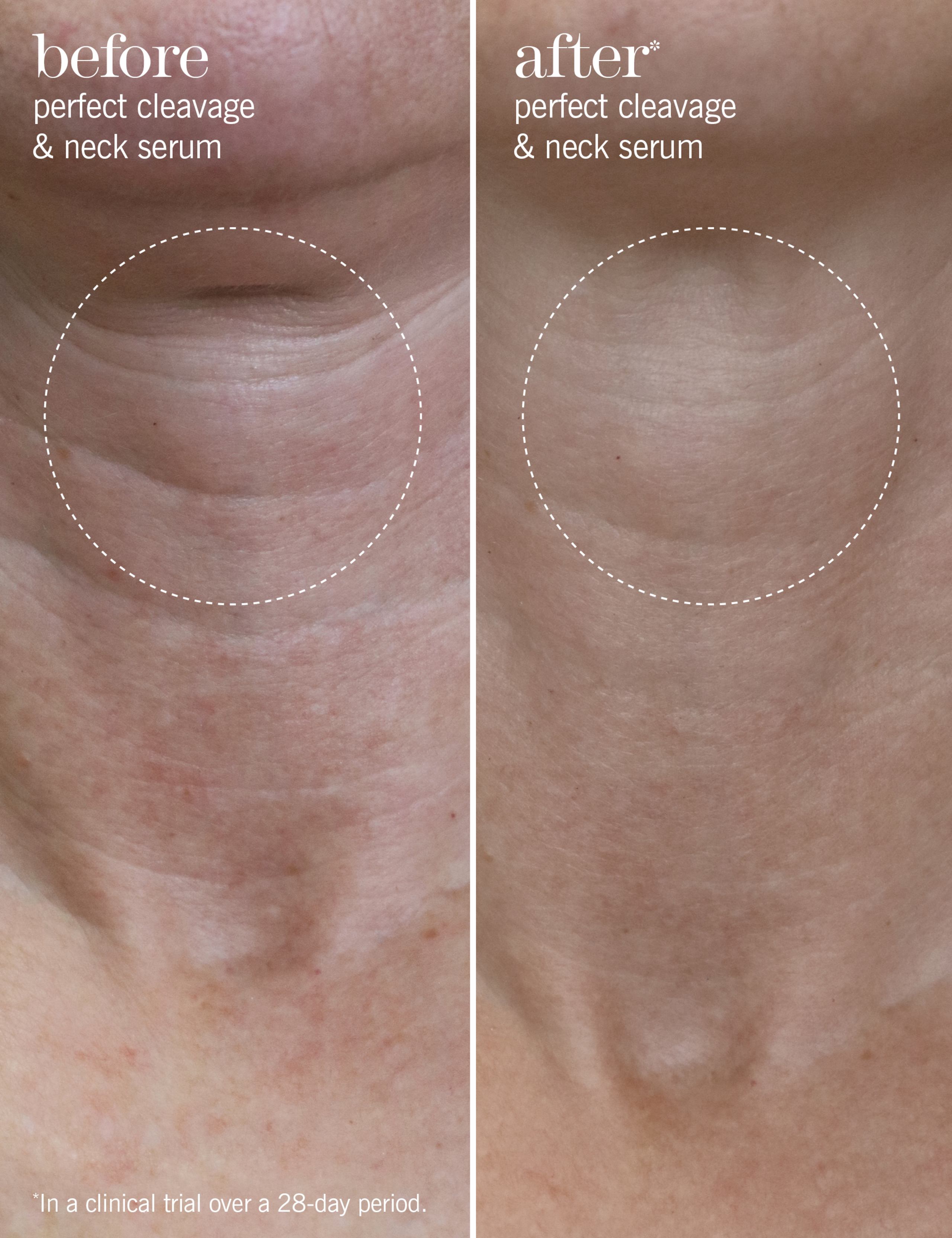 Perfect Cleavage & Neck Serum 150ml 5 of 8