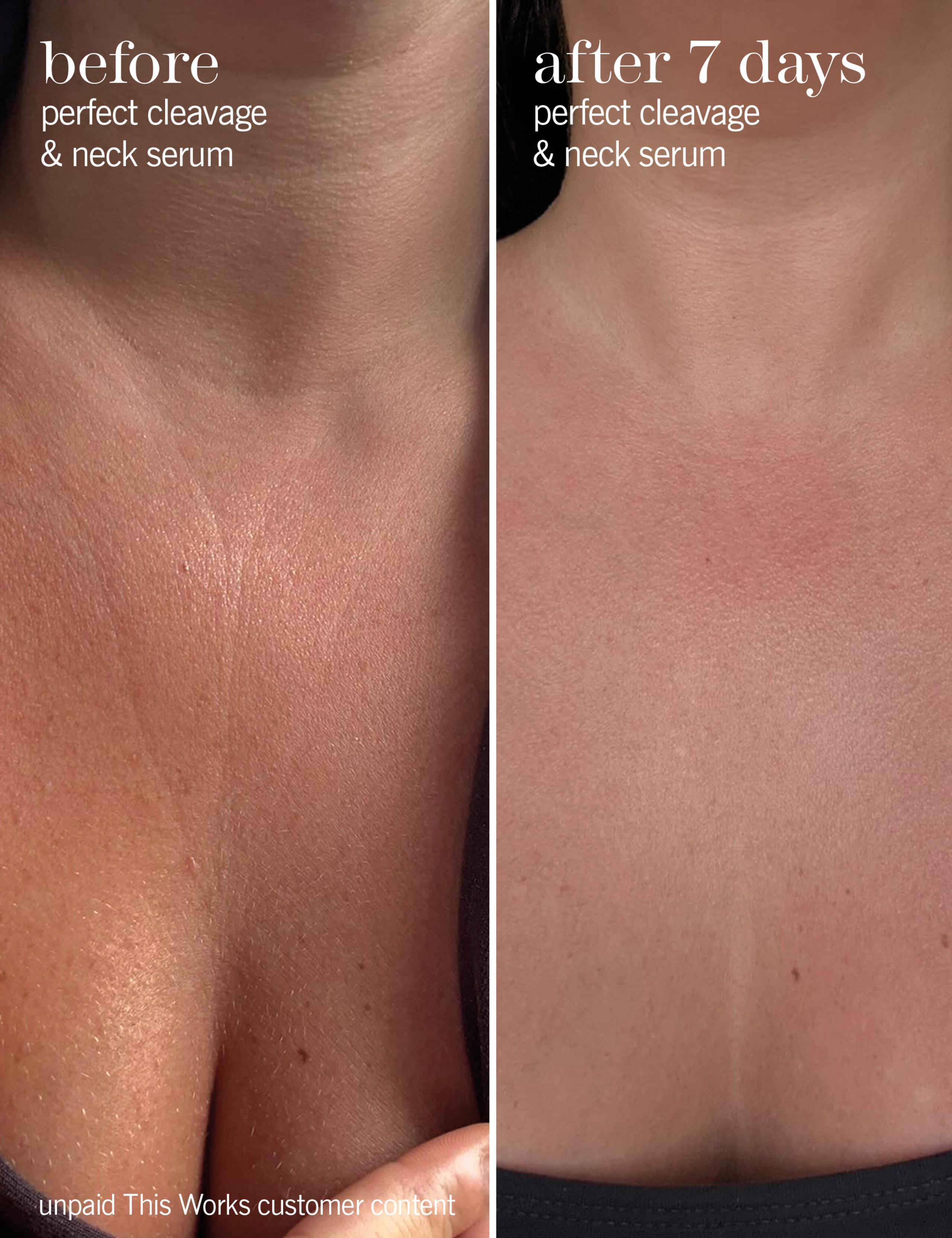 Perfect Cleavage & Neck Serum 150ml 6 of 8