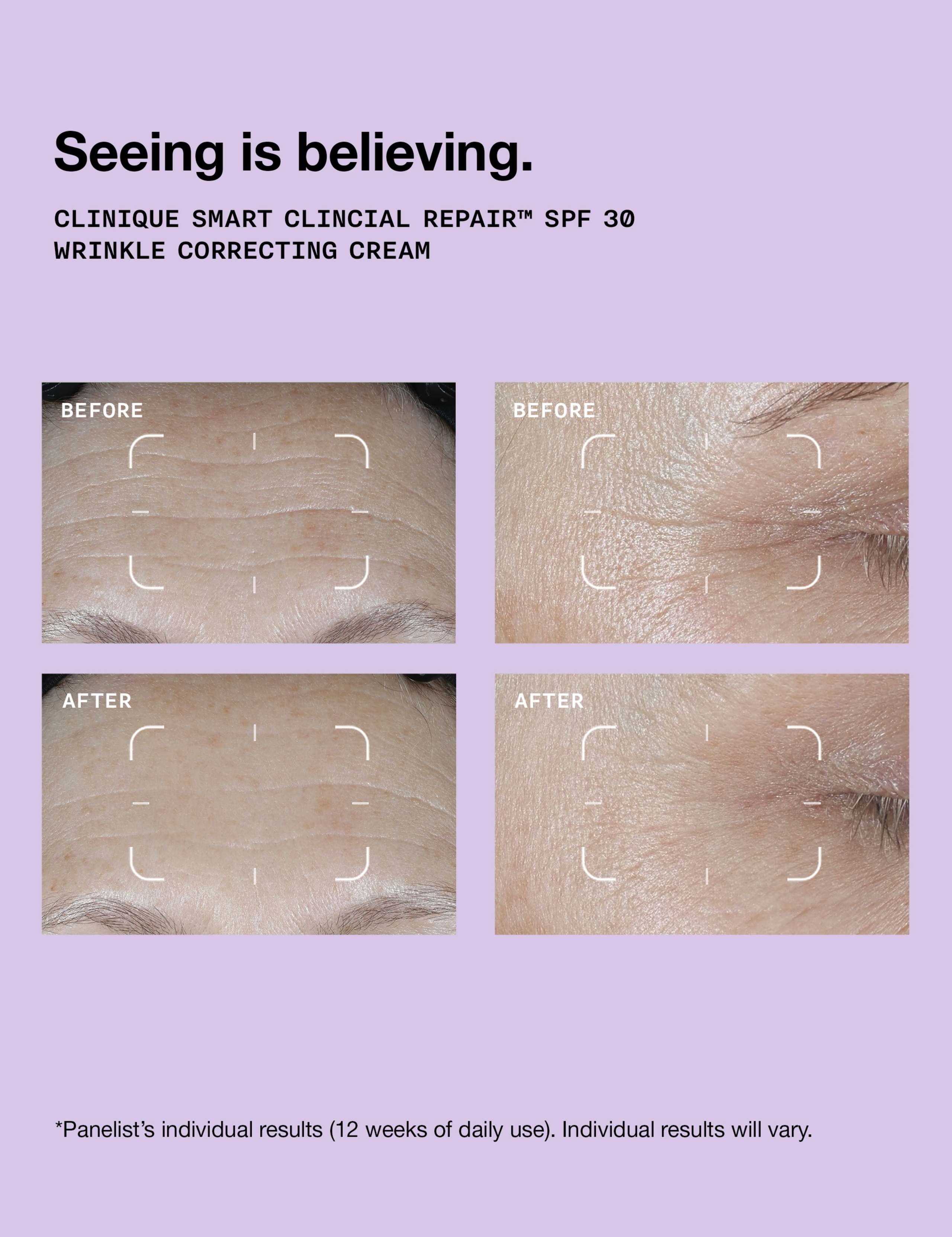 Smart Clinical Repair™ SPF 30 Wrinkle Correcting Cream 50ml 3 of 8