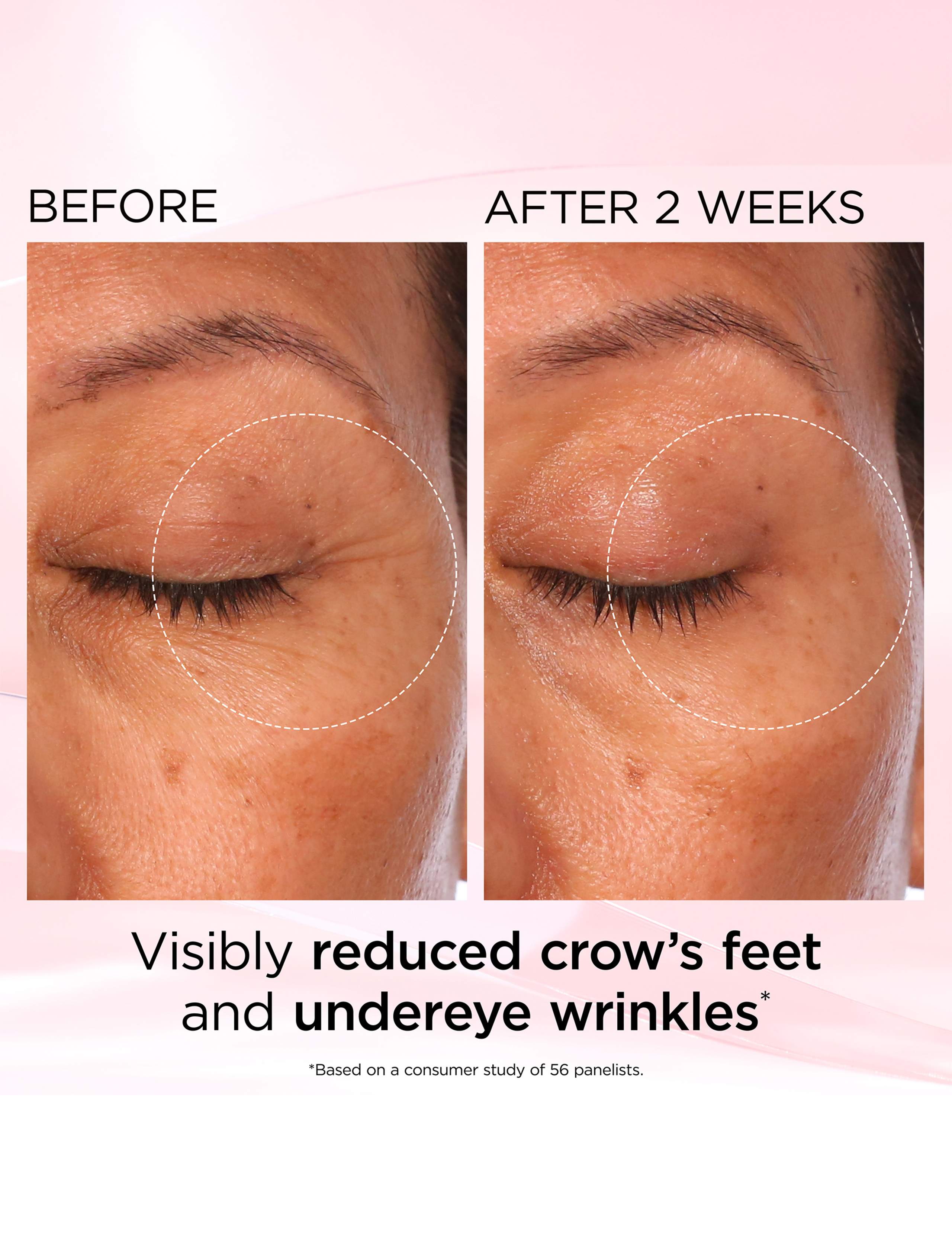 Retinol + HPR Ceramide Rapid Skin Renewing Eye Cream 15ml 8 of 9